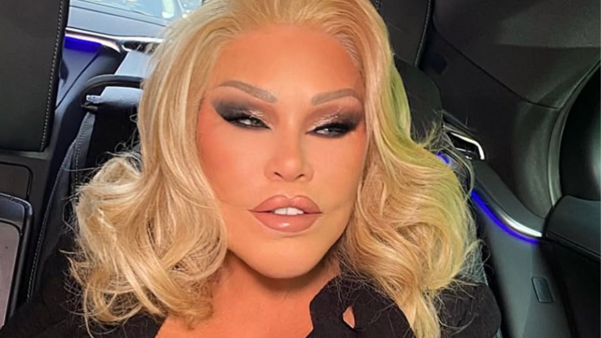 Morre socialite Jocelyn Wildenstein, conhecida como ‘mulher gato’ por inúmeras plásticas