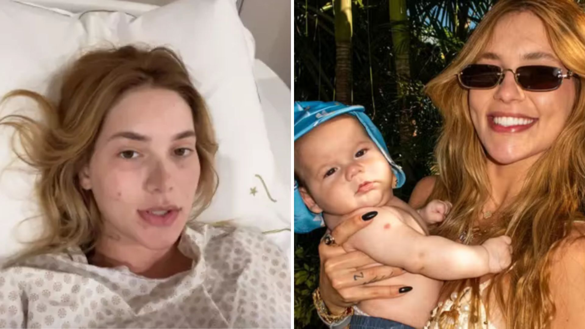 Quais cirurgias Virginia Fonseca fez? Influencer fez ‘correções’ após terceiro filho