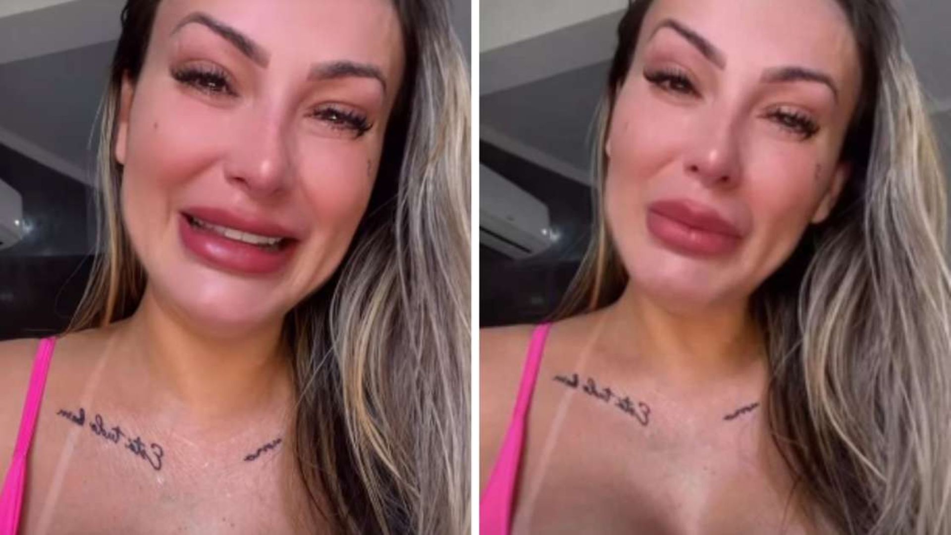 Andressa Urach fraturou a coluna? Especialistas explicam grave dano após acidente
