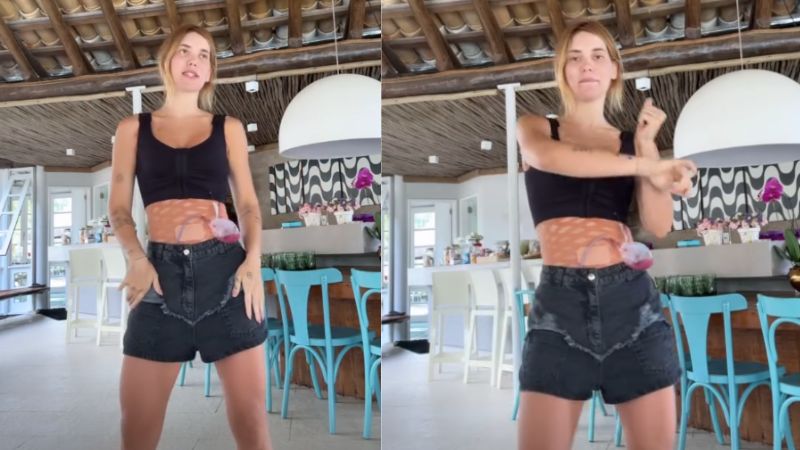 Três dias após cirurgia, Virginia dança com dreno e taping: ‘Já vou de drenagem’