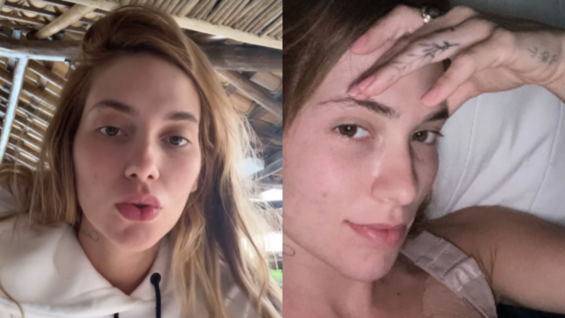 Virginia Fonseca revela barriga uma semana após a cirurgia de hérnia umbilical: ‘Bora desinchar’