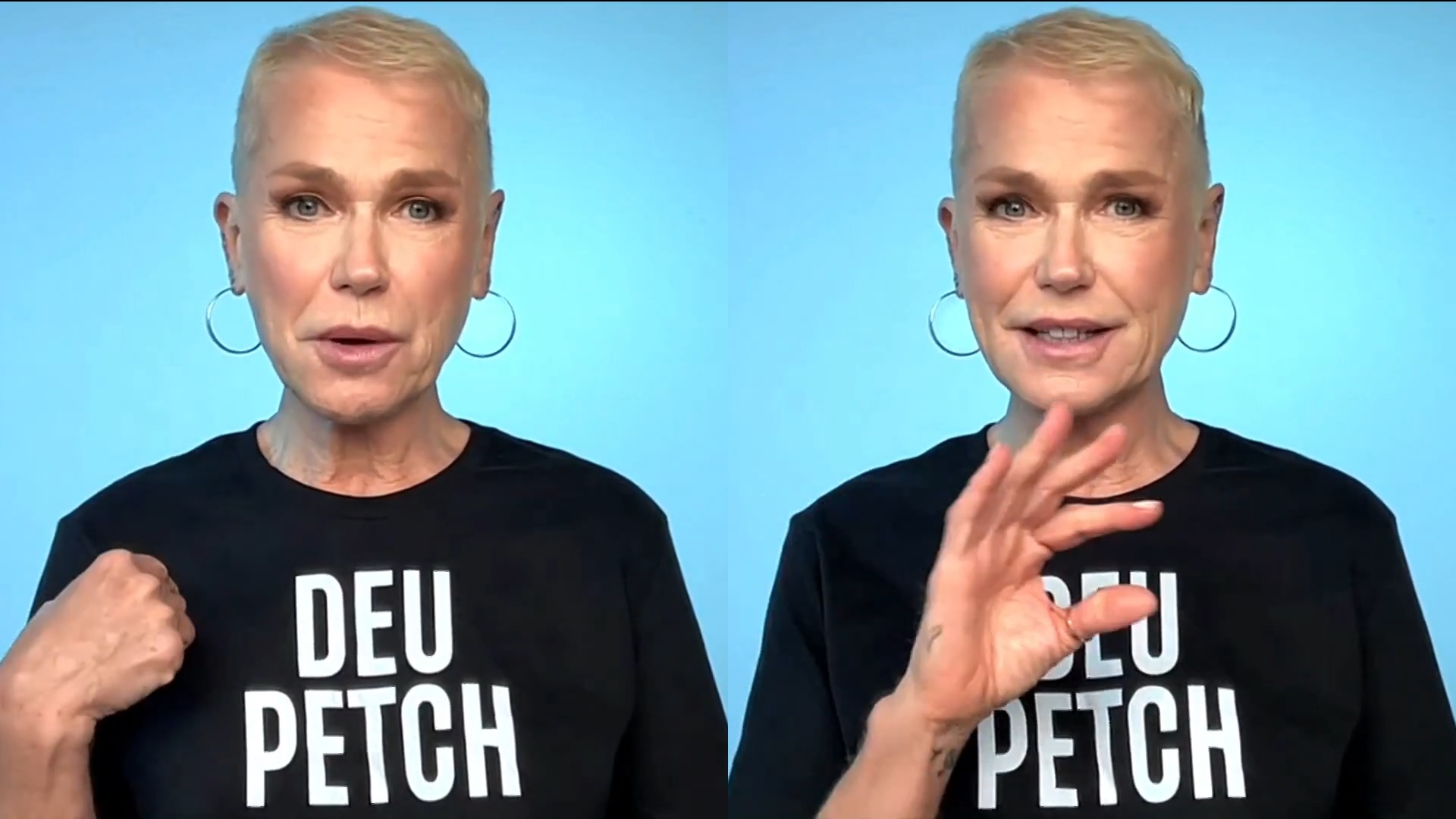 Xuxa vai raspar a cabeça? Entenda tudo sobre alopecia androgenética, doença da apresentadora