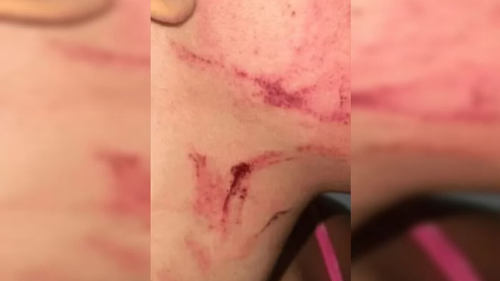 Homem é preso após tentar matar mulher estrangulada para beber o sangue dela