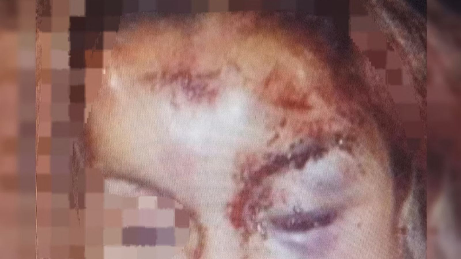 Mulher sofre agressão do companheiro após receber ligação de outro homem