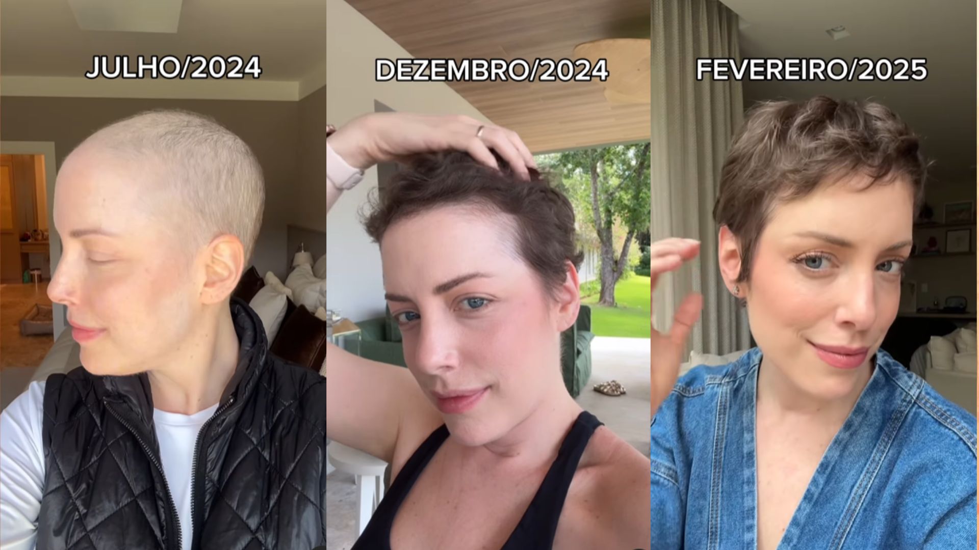 Fabiana Justus compartilha evolução do cabelo após tratamento contra câncer; veja