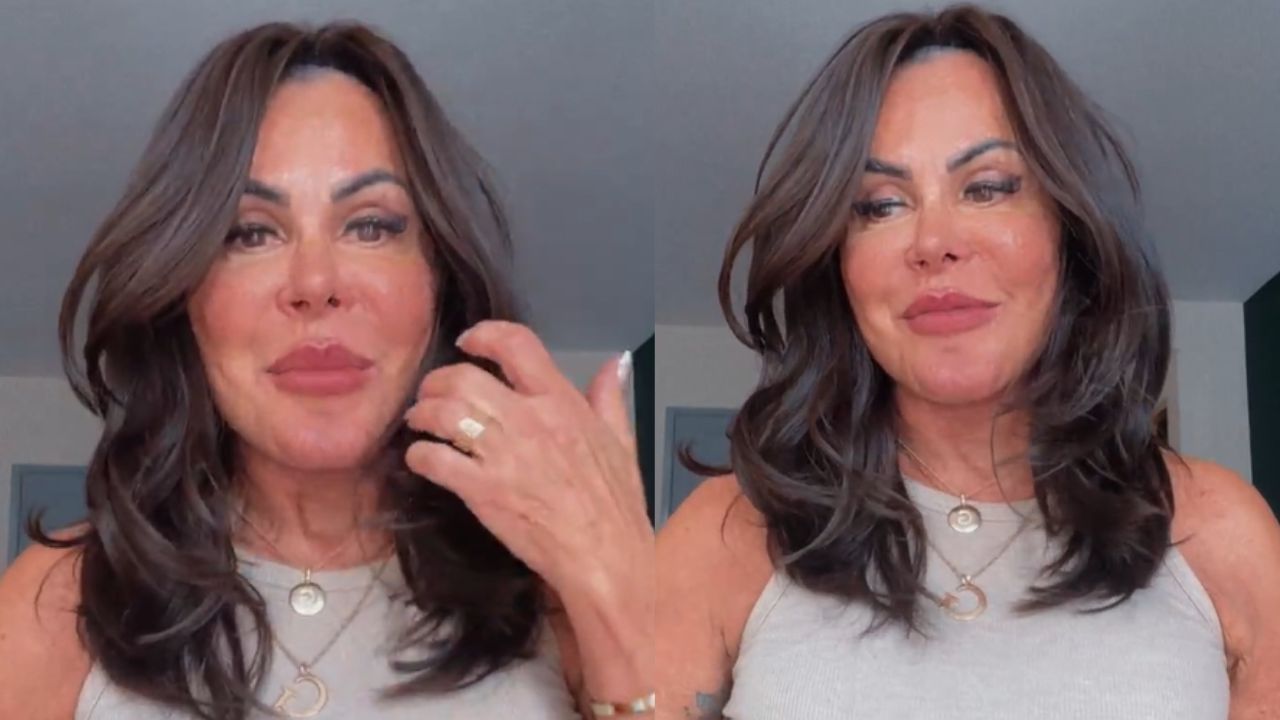 Gretchen expõe motivo de retirada de preenchimento labial: ‘Estava pesando’