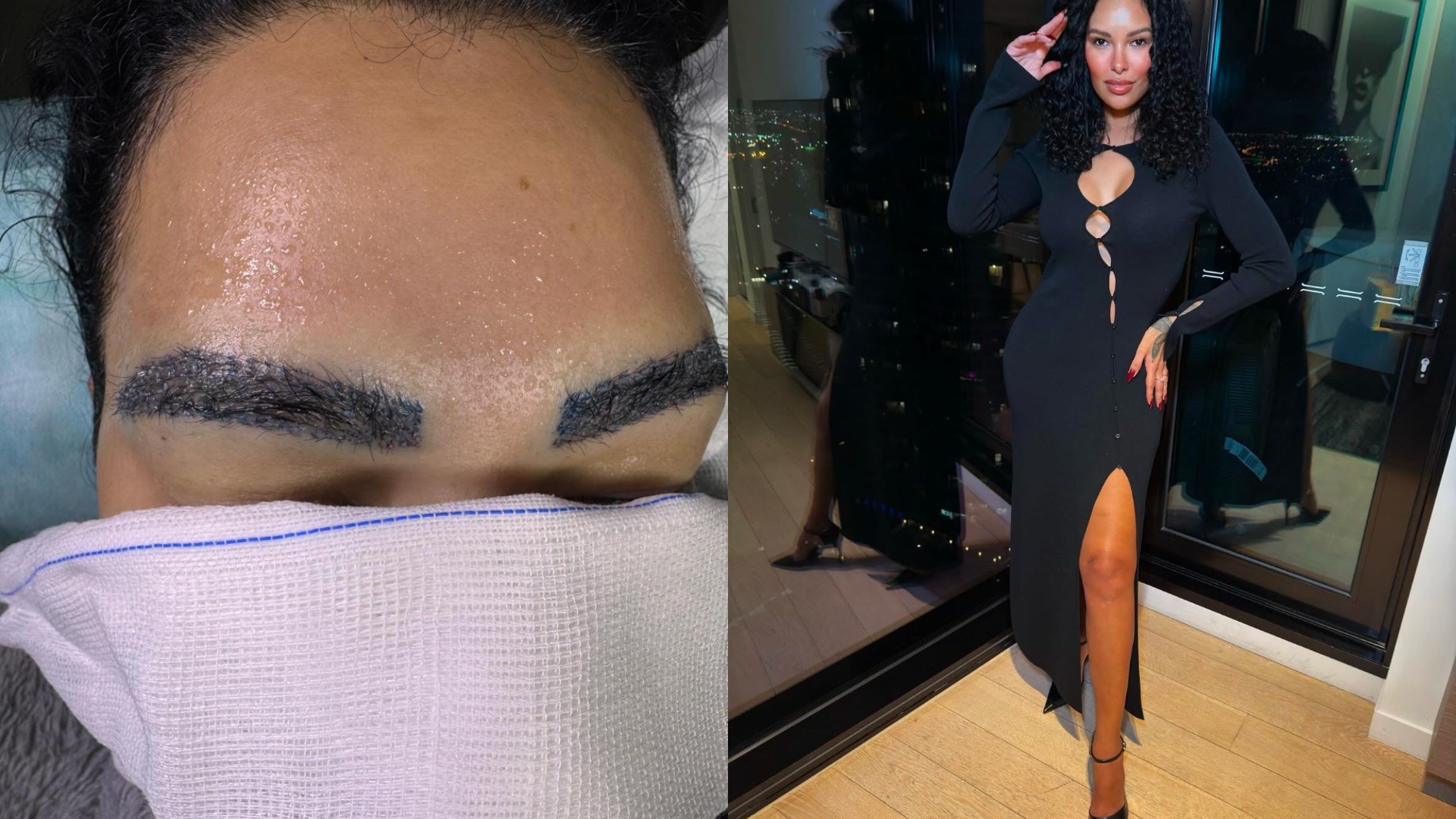 Exclusiva! Ex-BBB Ariadna faz transplante de sobrancelha e detalha recuperação