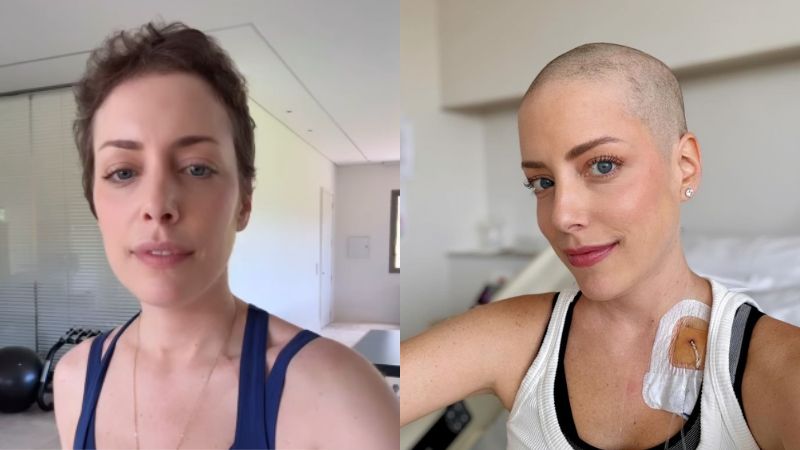 Fabiana Justus desabafa um ano após raspar a cabeça: ‘Recomeço de vida’