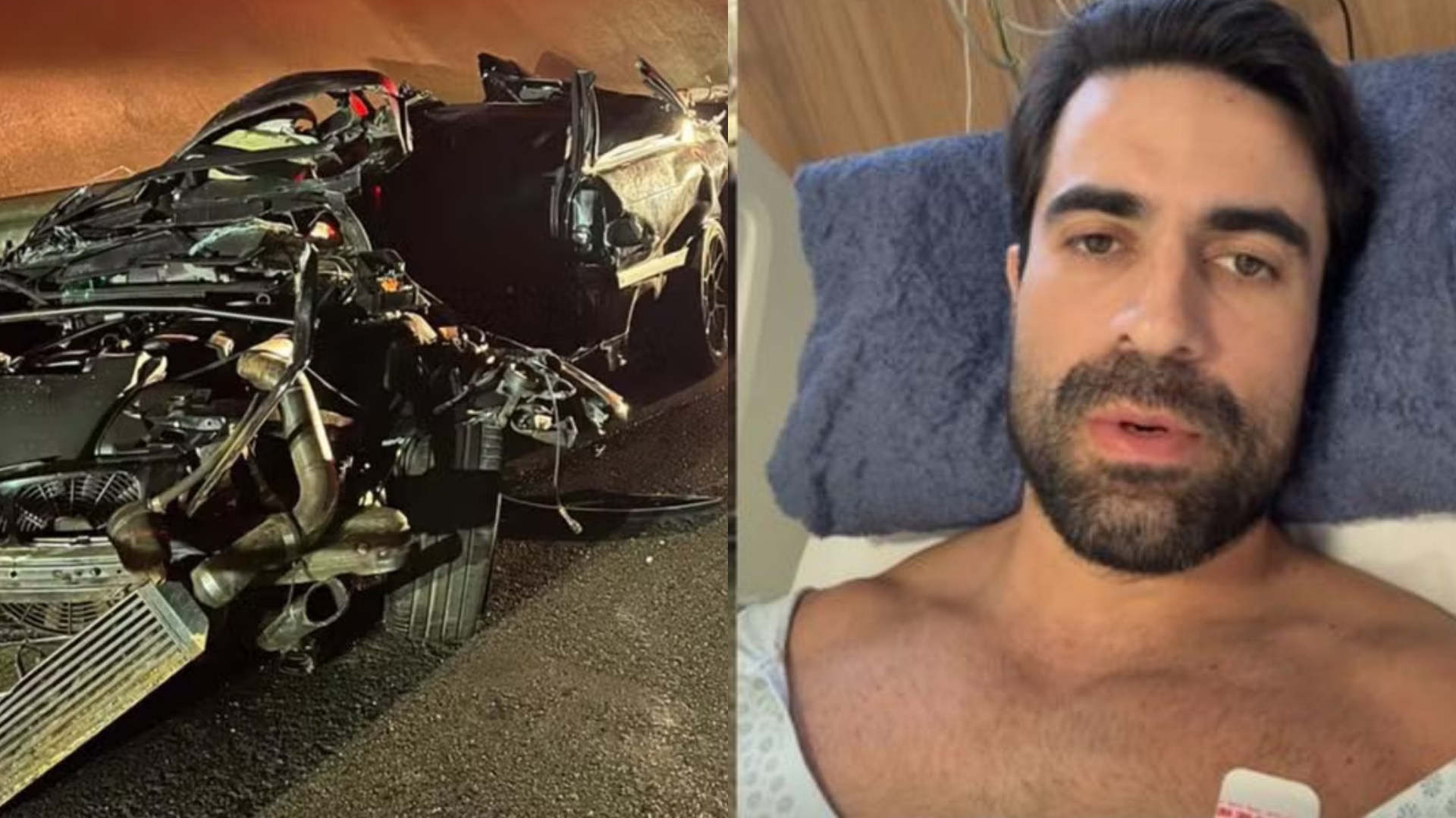 Influenciador que perdeu os pés após capotar BMW em SP chora em alta hospitalar: ‘Só o começo’