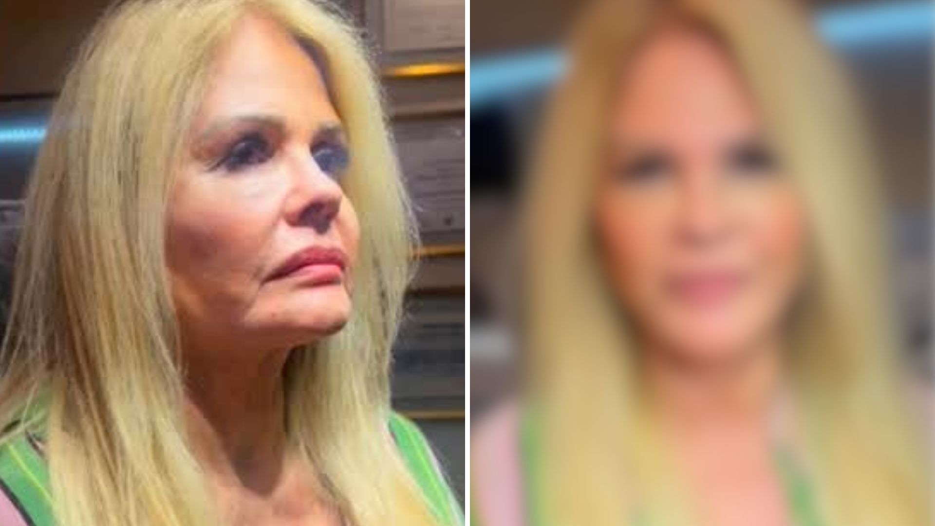 Monique Evans surge com rosto renovado após harmonização: veja antes e depois
