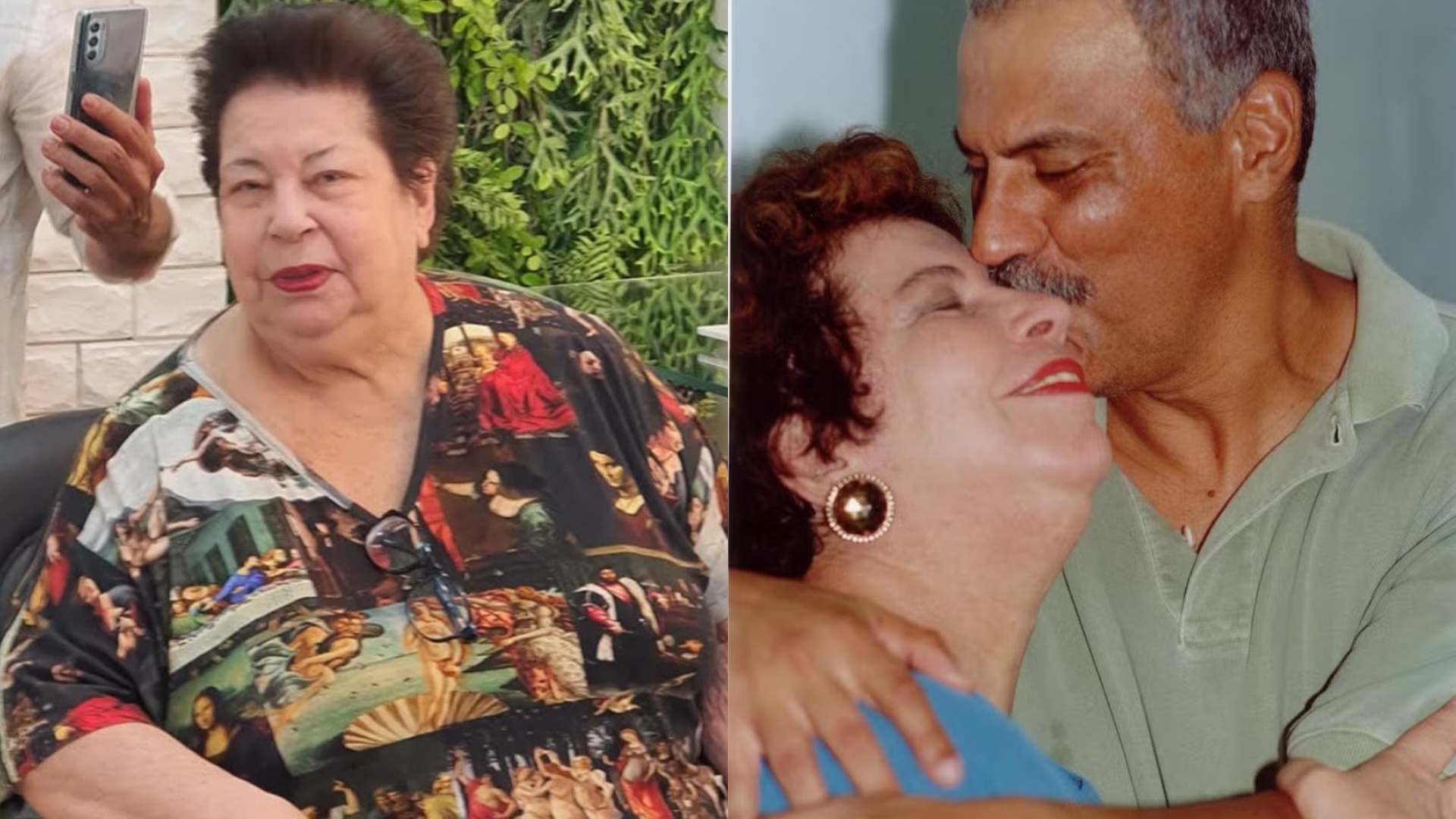 Nana Caymmi tem estado de saúde preocupante atualizado pelo irmão: ‘Quase faleceu’