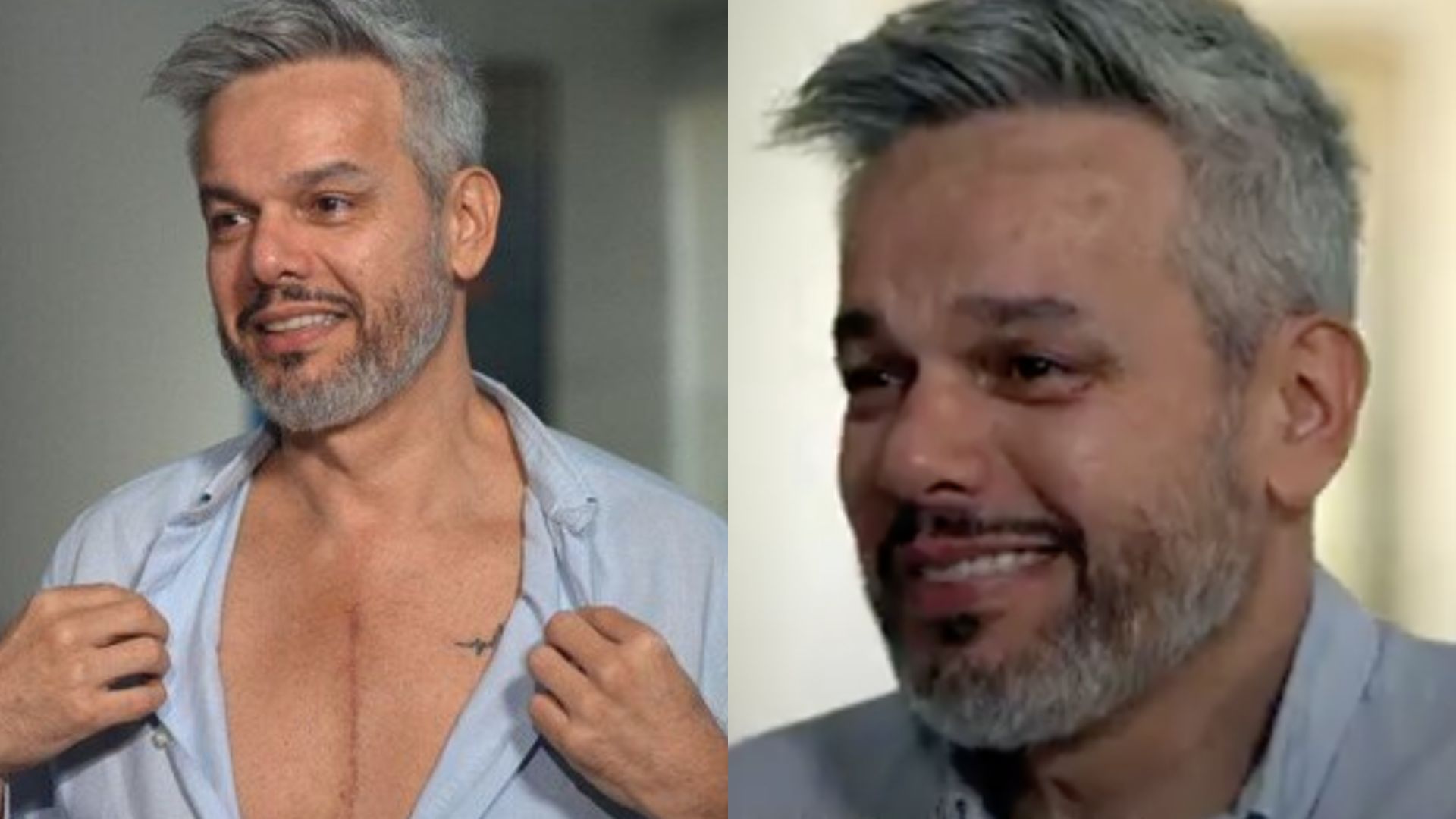 Otaviano Costa se emociona ao falar de aneurisma: ‘Cicatriz é milagre da vida’