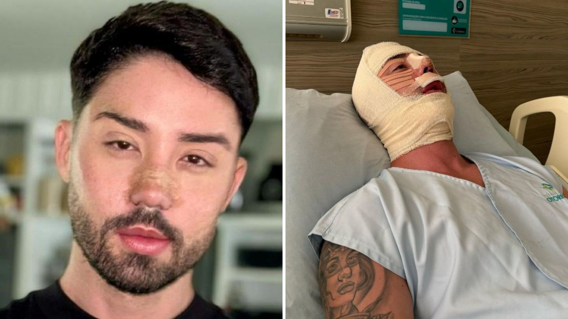 Rico Melquiades surge irreconhecível ao passar por 11ª cirurgia: ‘Refiz’