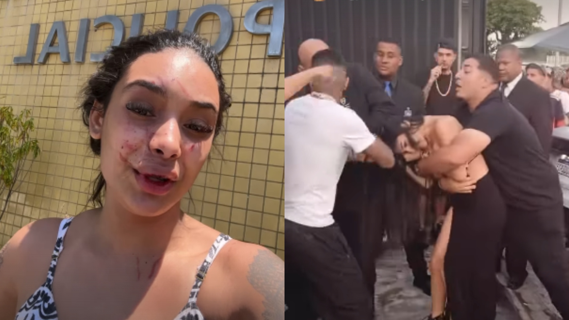 Mulher que se envolveu em treta diz que apanhou do namorado de Bia Miranda: ‘Covarde’