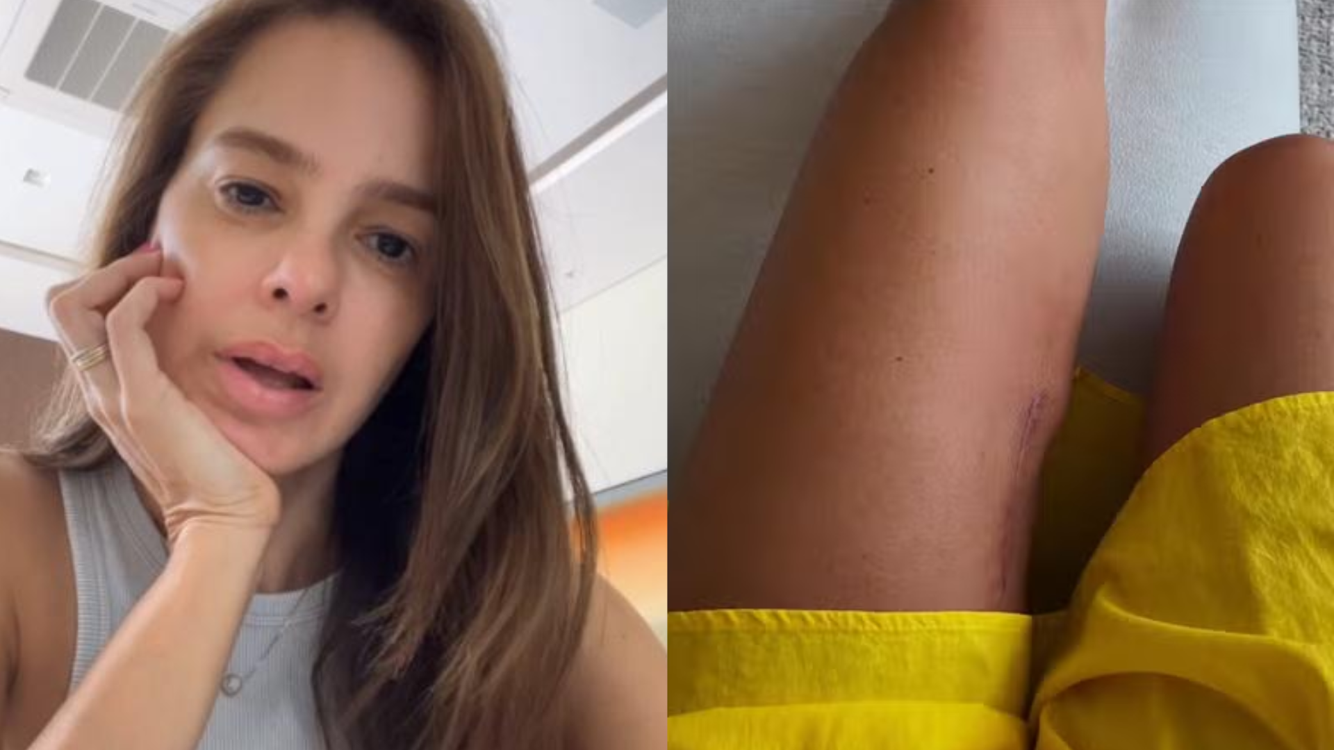 Vera Viel revela sequela após batalha contra tumor maligno: ‘Inchaço’