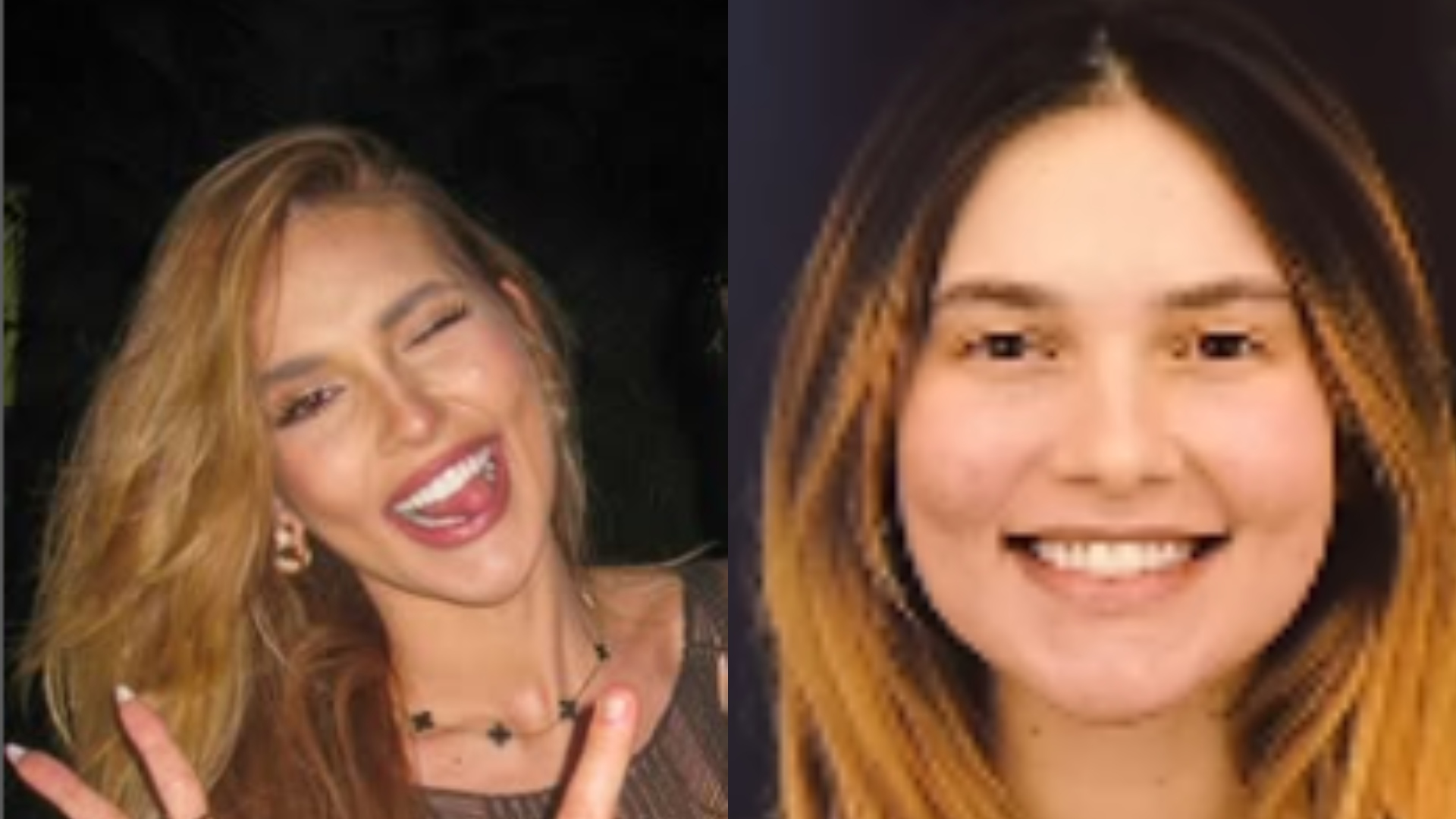 Mudou muito? Dentista detalha mudança no sorriso de Virginia Fonseca: ‘Corrigiu’