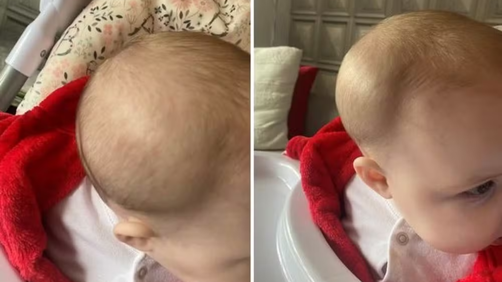 Absurdo! Mãe descobre fratura no crânio ao buscar bebê em creche