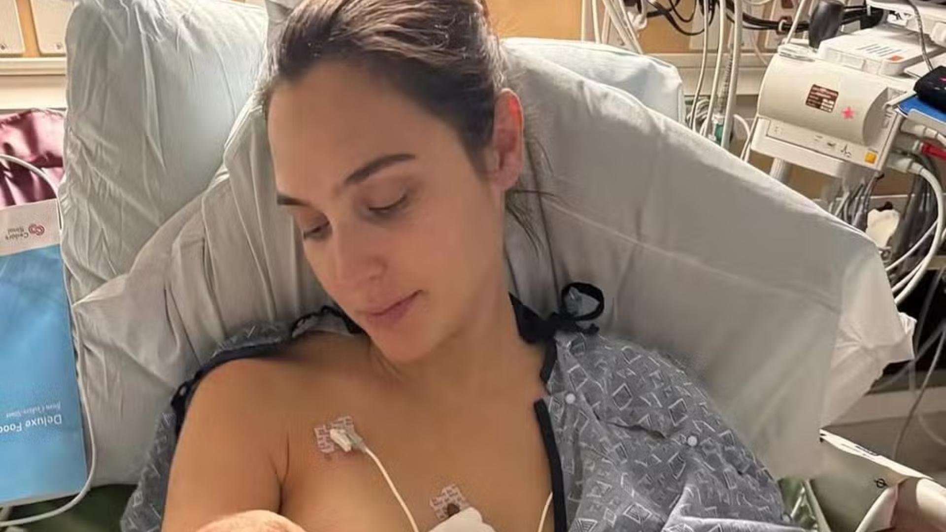 Coágulo cerebral na gravidez: entenda o episódio enfrentado pela atriz de Mulher Maravilha