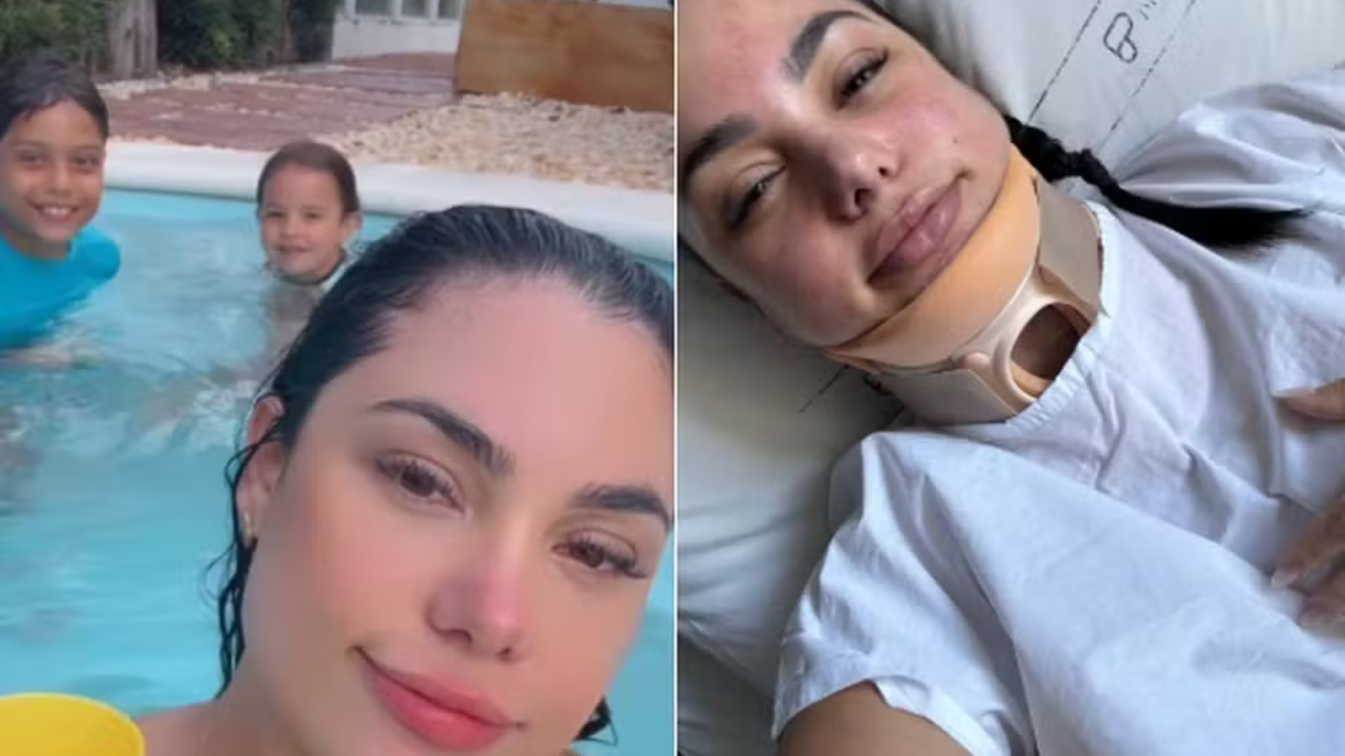 Mulher quebra cervical e quase se afoga após cabelo ficar preso em sugador de piscina, no RS