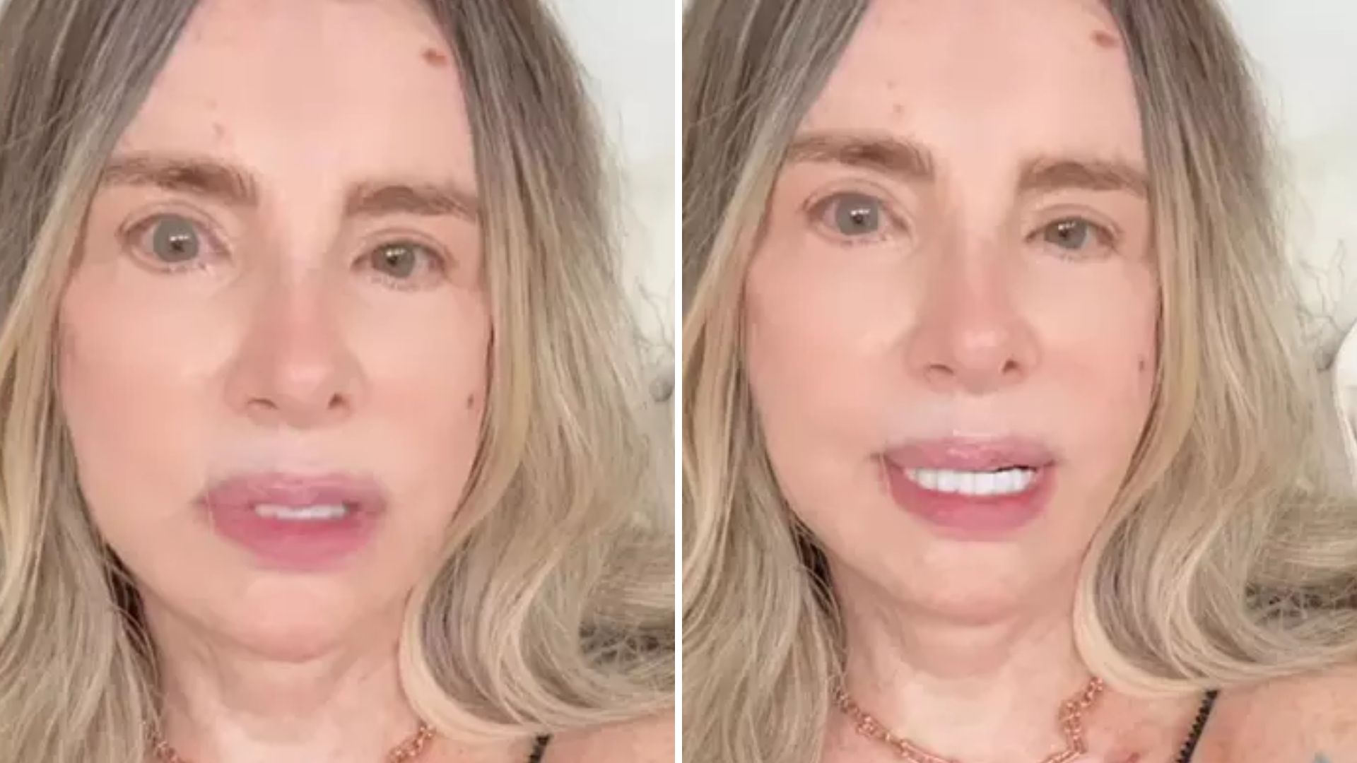 ‘Sozinha e traída’: Isis de Oliveira enfrenta câncer e expõe caso do ex e sobrinha