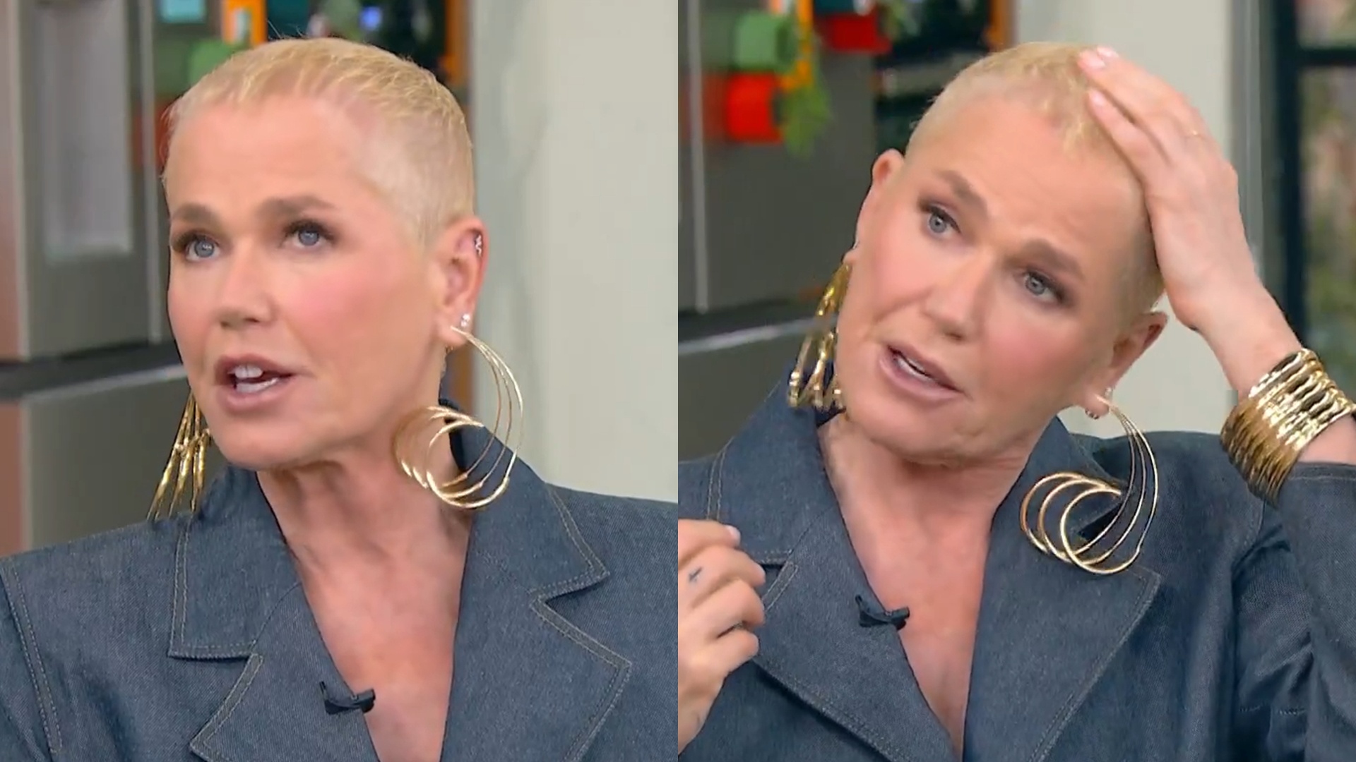Médico comenta caso de Xuxa e explica cuidados essenciais no pós-operatório: ‘Melhores resultados’