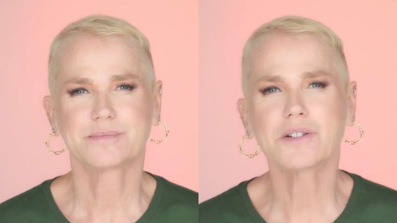 Xuxa revela que fez implante capilar e detalha tratamento: ‘Me incomodava bastante’