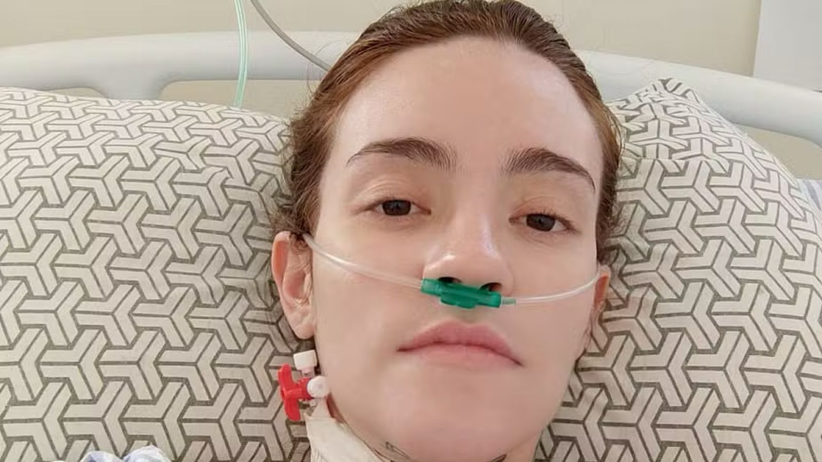 Médico explica diagnóstico da brasileira que vive com a ‘pior dor do mundo’: ‘Muito forte’