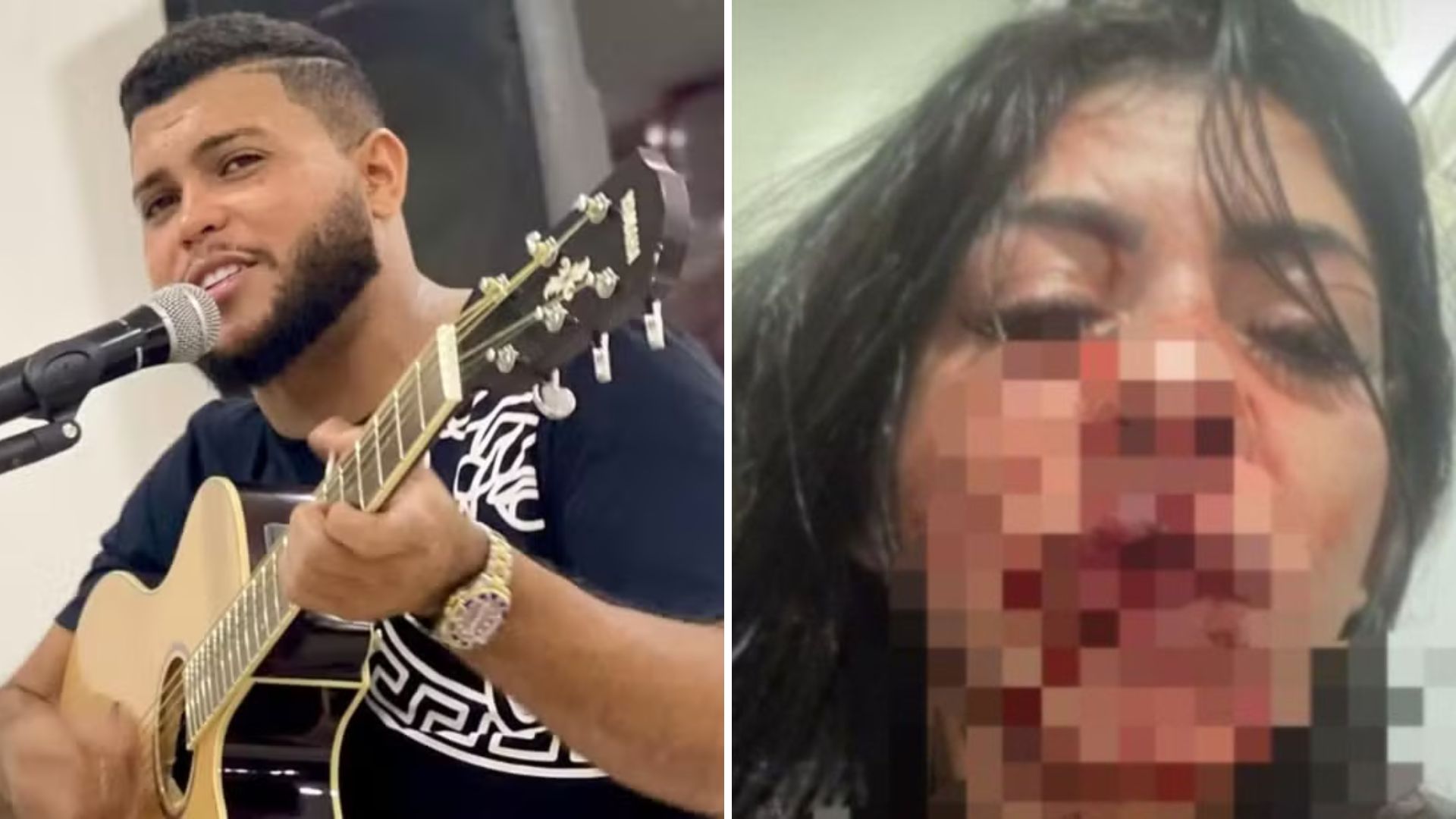 Cantor de forró vai ser preso? Artista esmurrou a namorada até arrancar os dentes