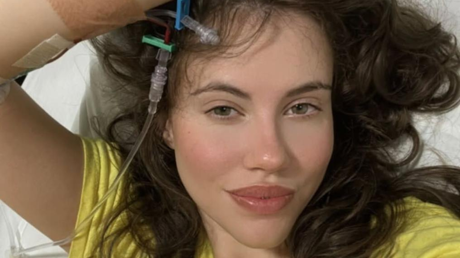 Médico explica diagnóstico de trombose profunda em atriz: ‘Quadro dramático’