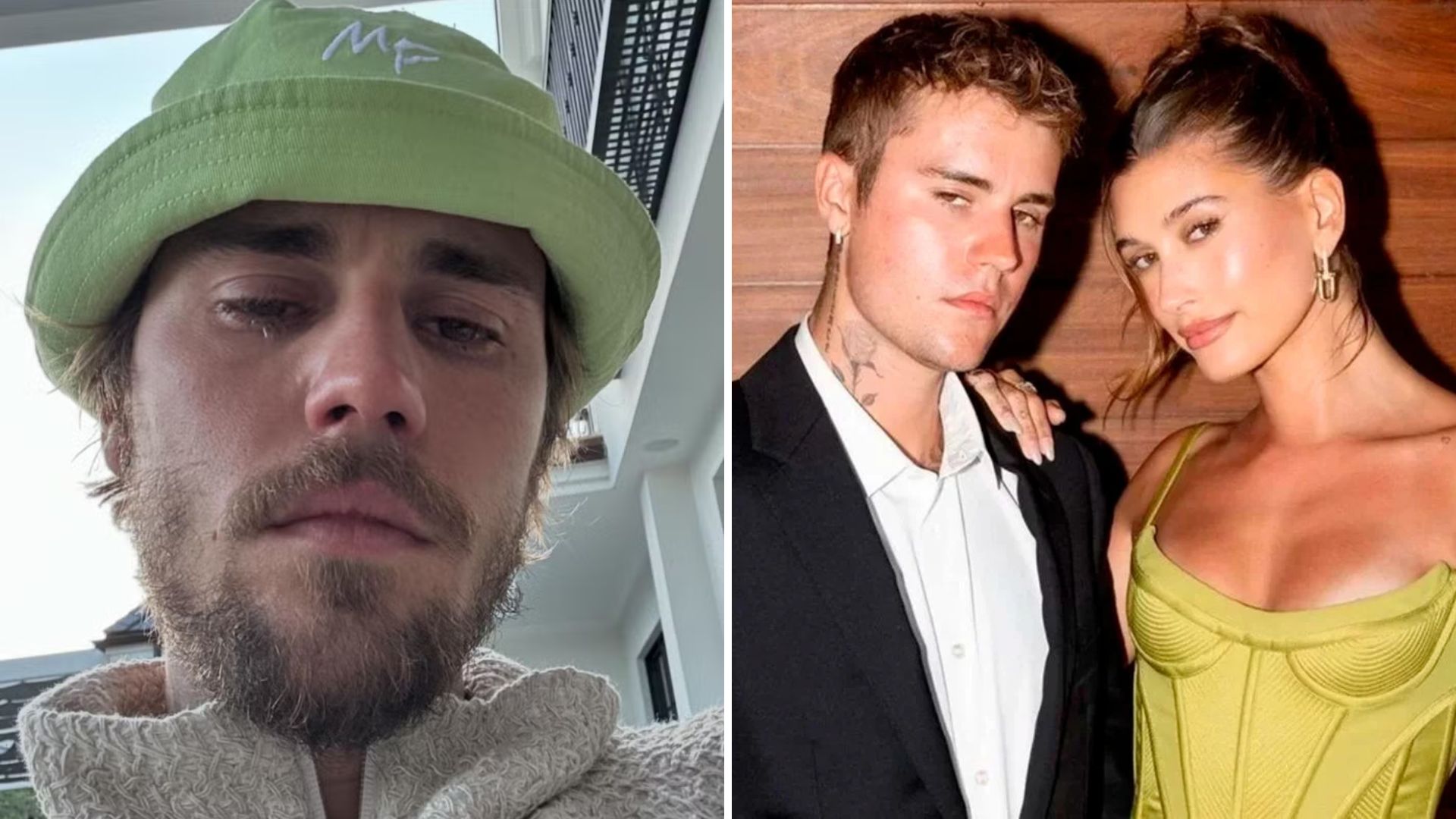 Crise no casamento de Justin Bieber e Hailey Bieber vem à tona: ‘Separação está próxima”