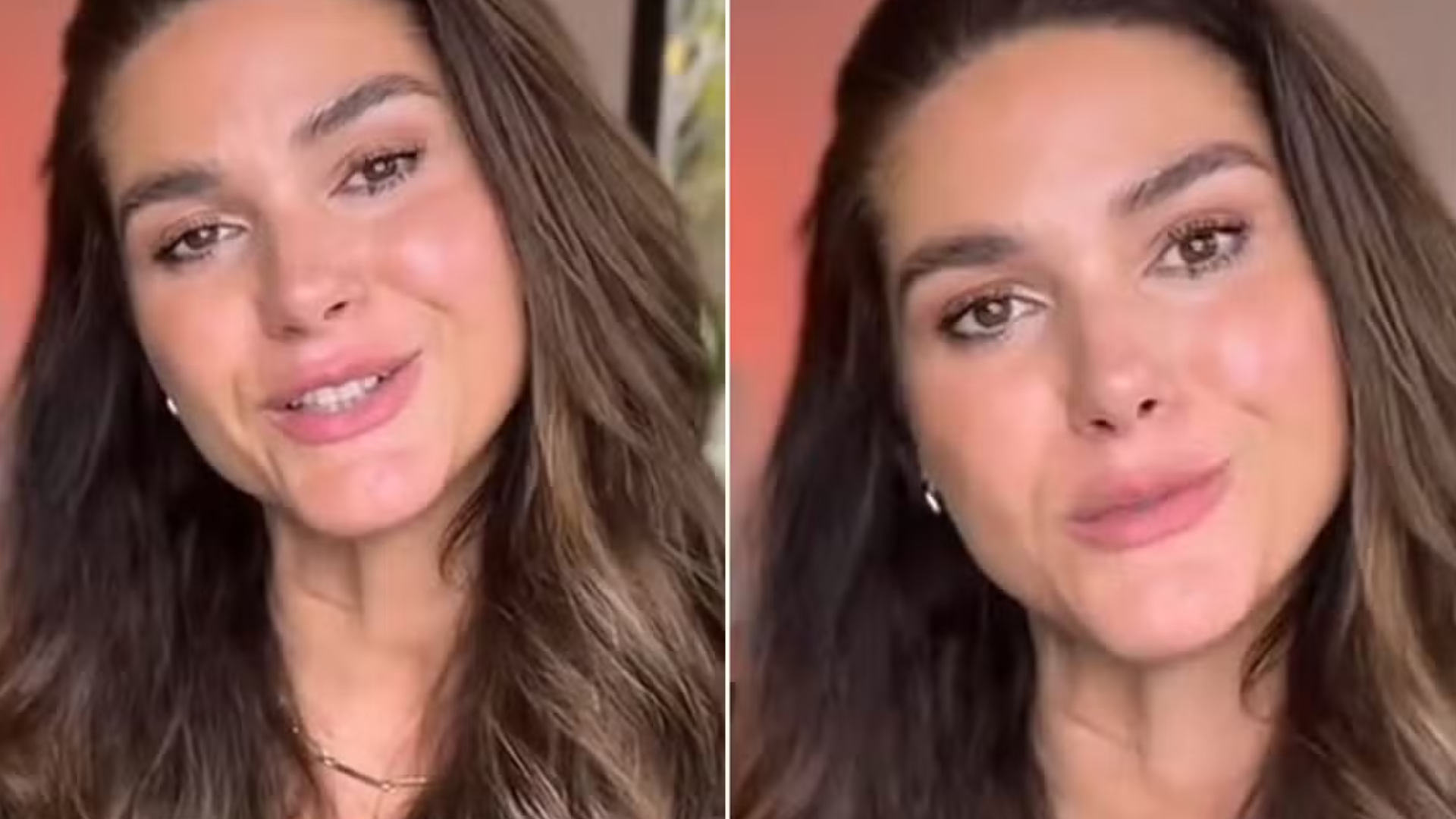 Médico explica diagnóstico irreversível de Fernanda Machado: ‘Transtornos’