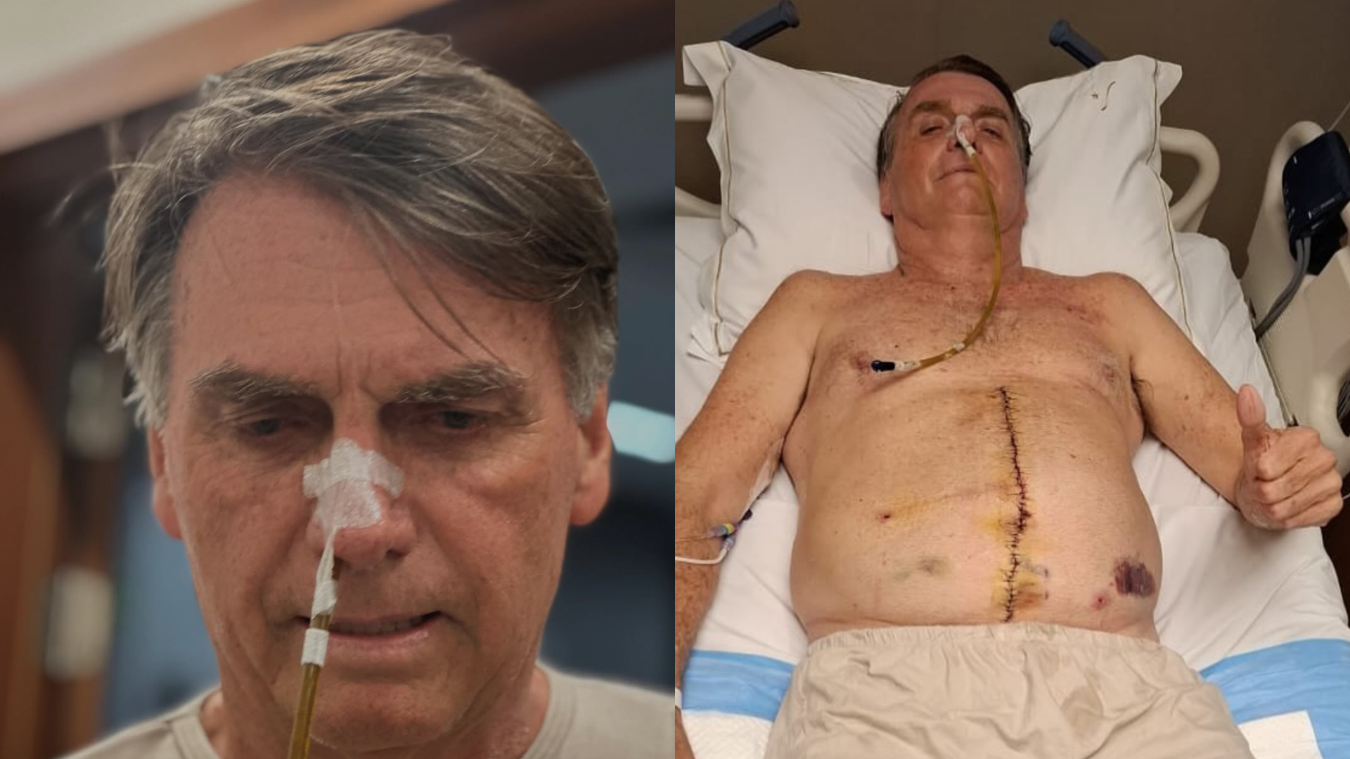 Na UTI, Bolsonaro é surpreendido com intimação do STF