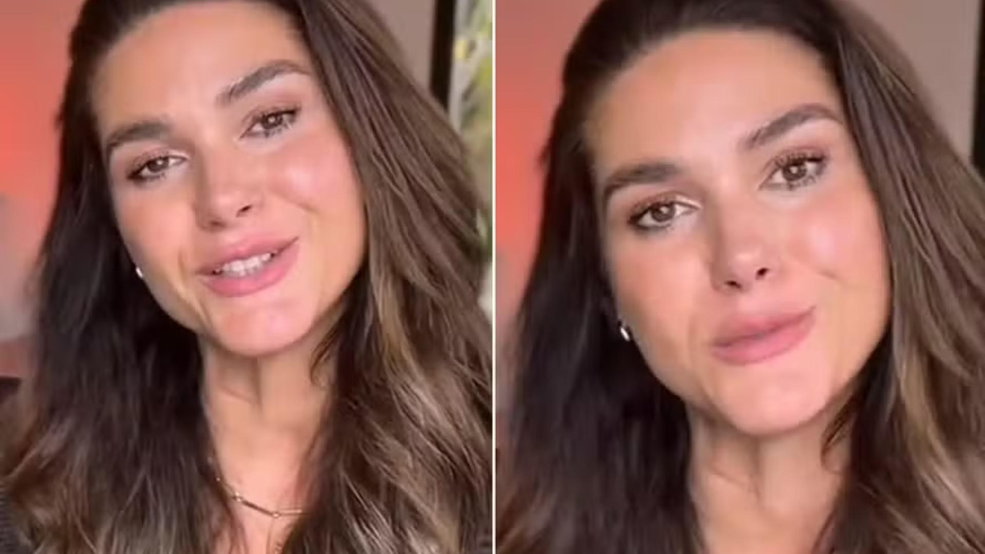 Ex-atriz da Globo, Fernanda Machado revela sofrer transtorno com sintomas graves e incapacitantes