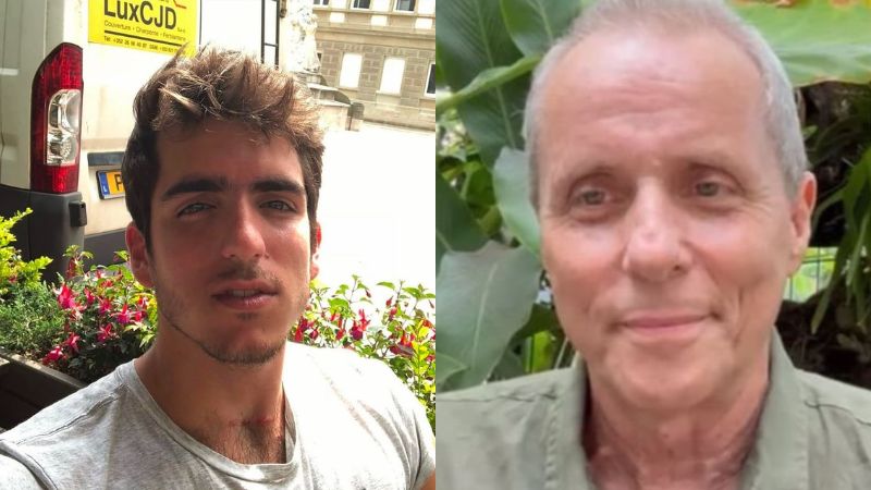 Filho de Tony Bellotto atualiza estado de saúde do pai após cirurgia: ‘Saiu da UTI’