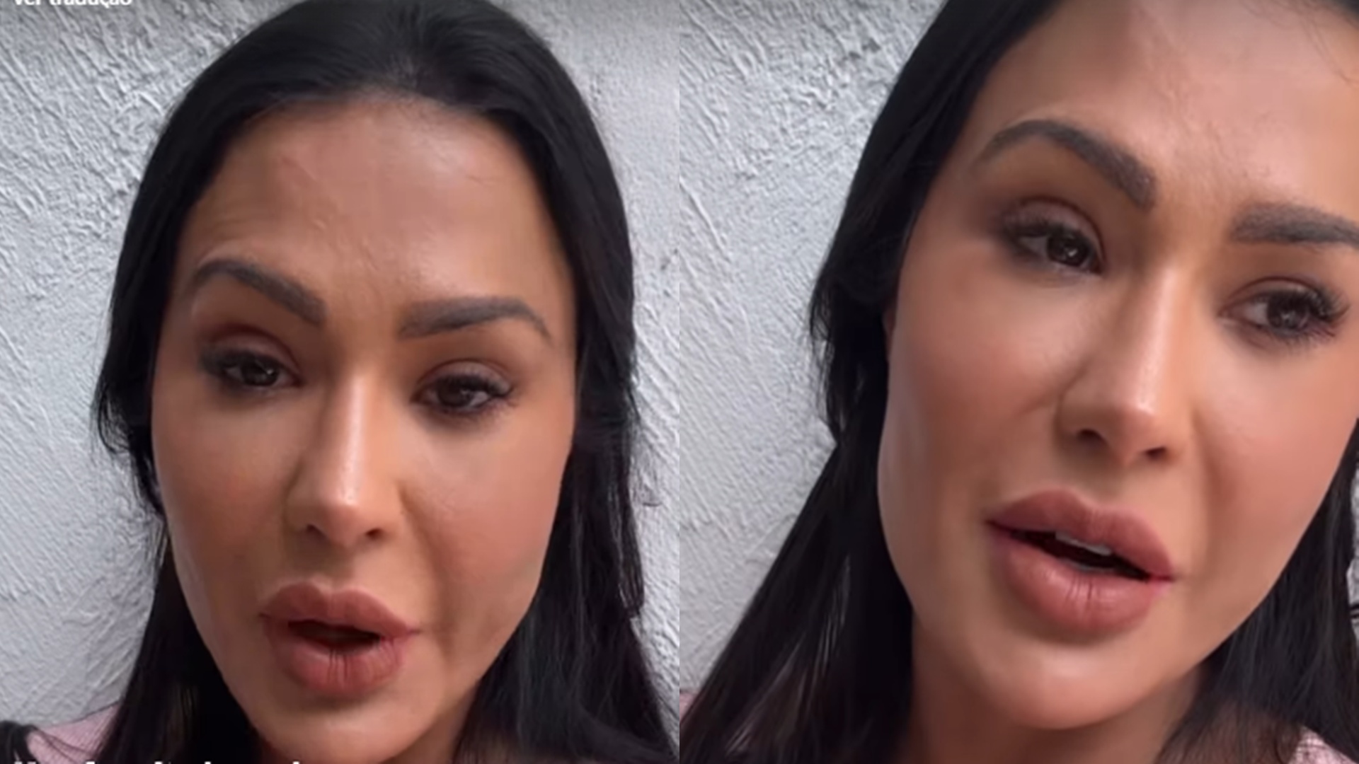 Gracyanne Barbosa preocupa ao expor dor desesperadora: ‘Parece uma faca entrando’