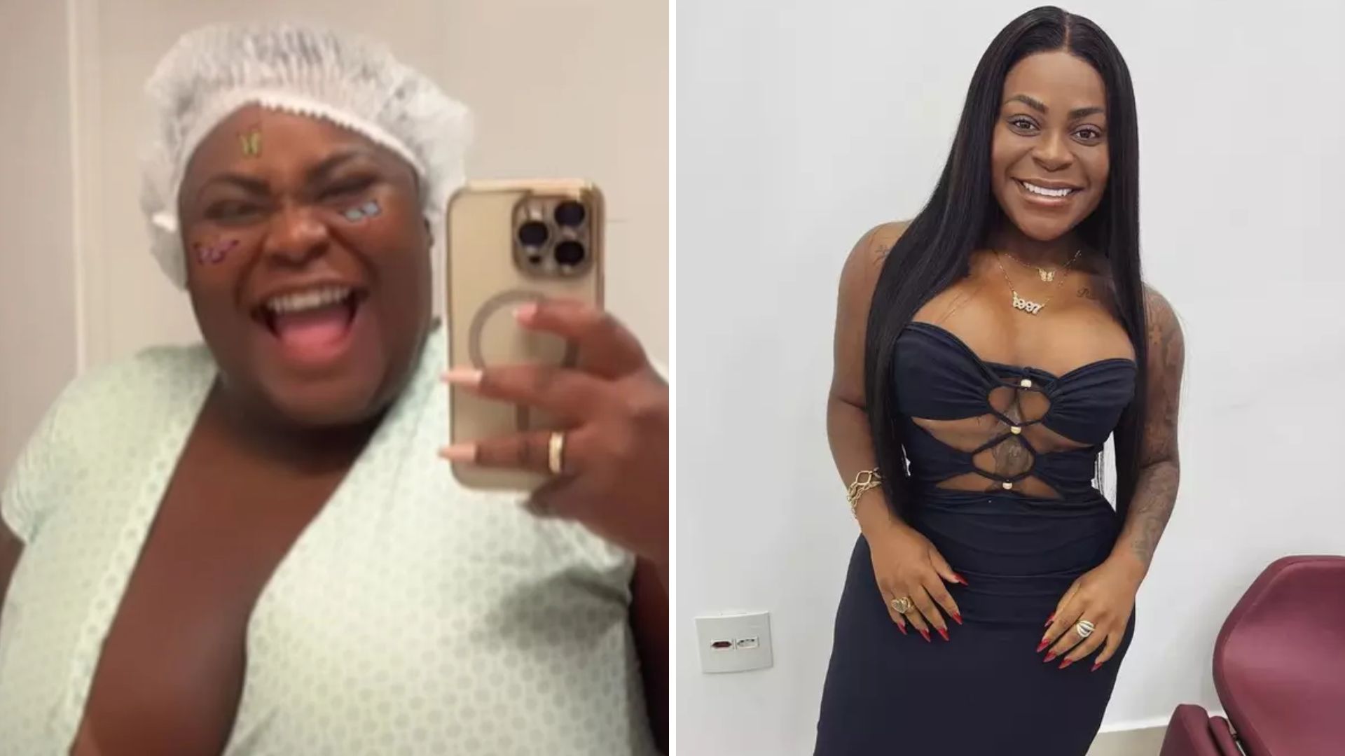 Hipocrisia? Jojo Todynho só fez a bariátrica graças ao SUS; entenda como