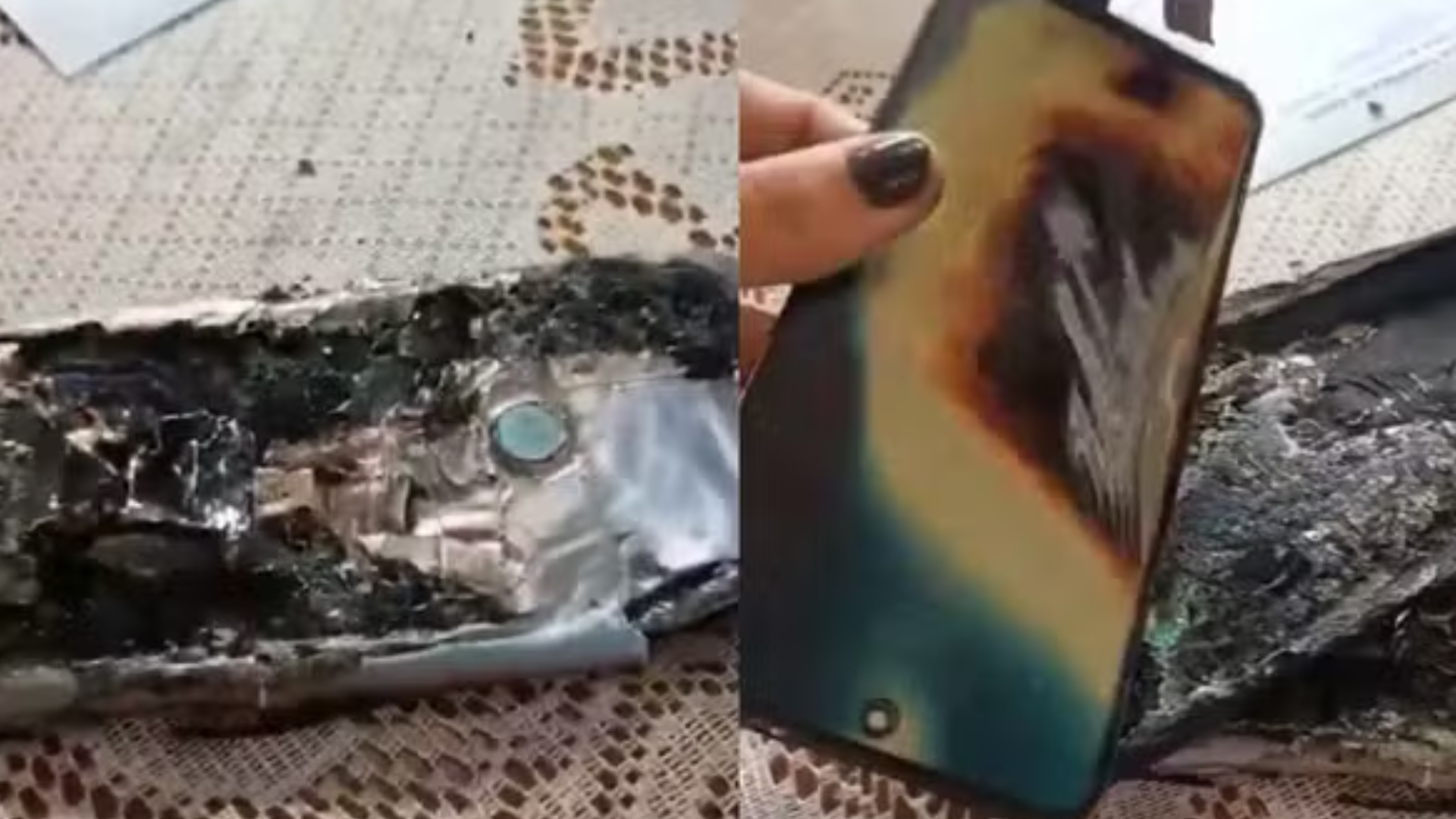 Perigo! Homem sofre queimaduras gravíssimas na perna após celular explodir