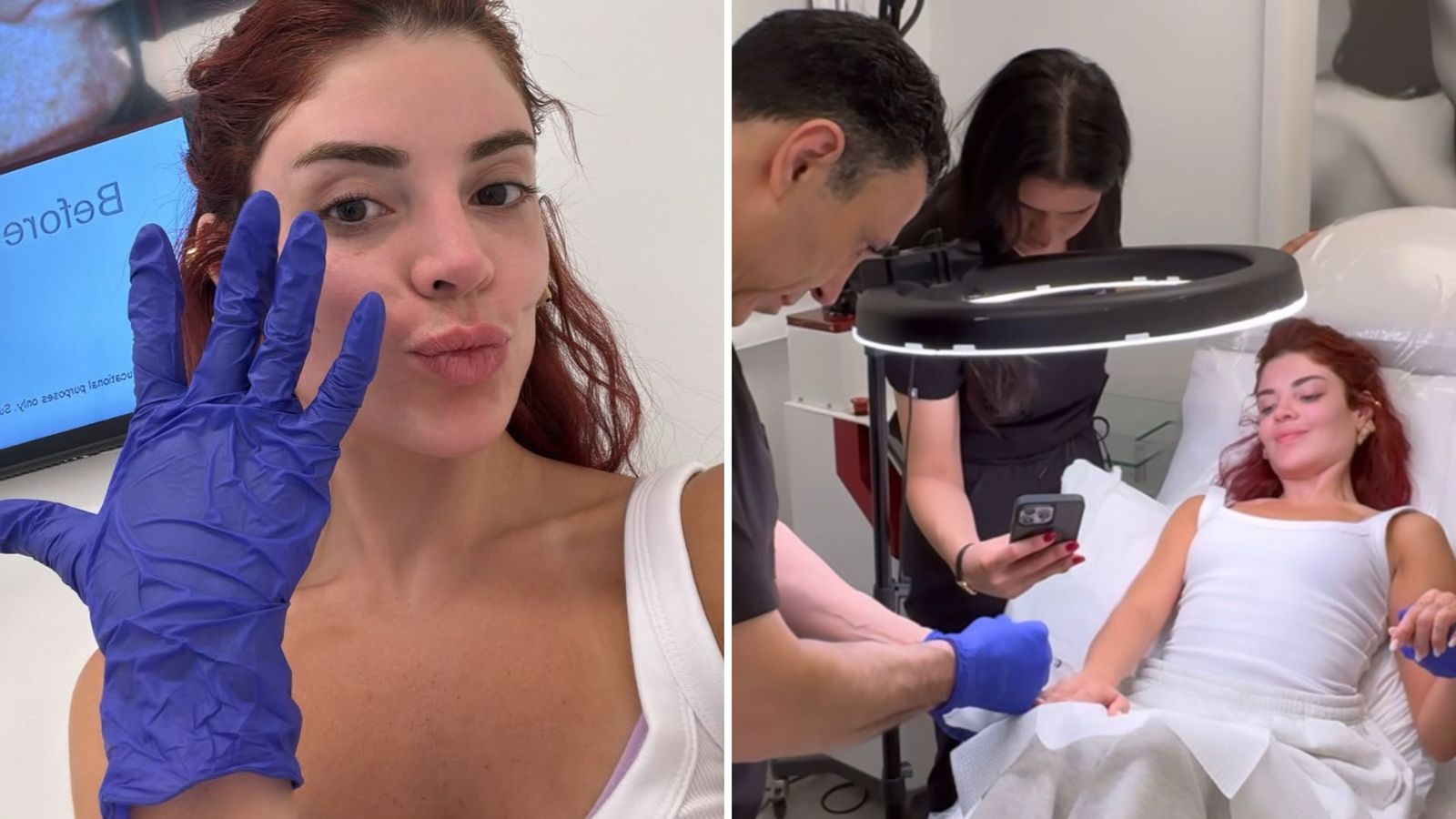 Gkay faz harmonização nas mãos e exibe resultado do novo procedimento estético: ‘Sonhos’