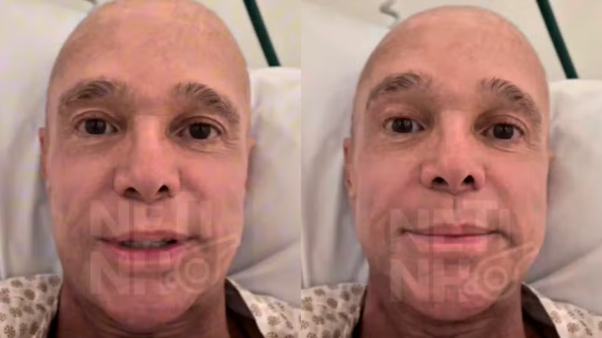 Internado, Netinho revela que fará transplante de medula após diagnóstico de câncer raro