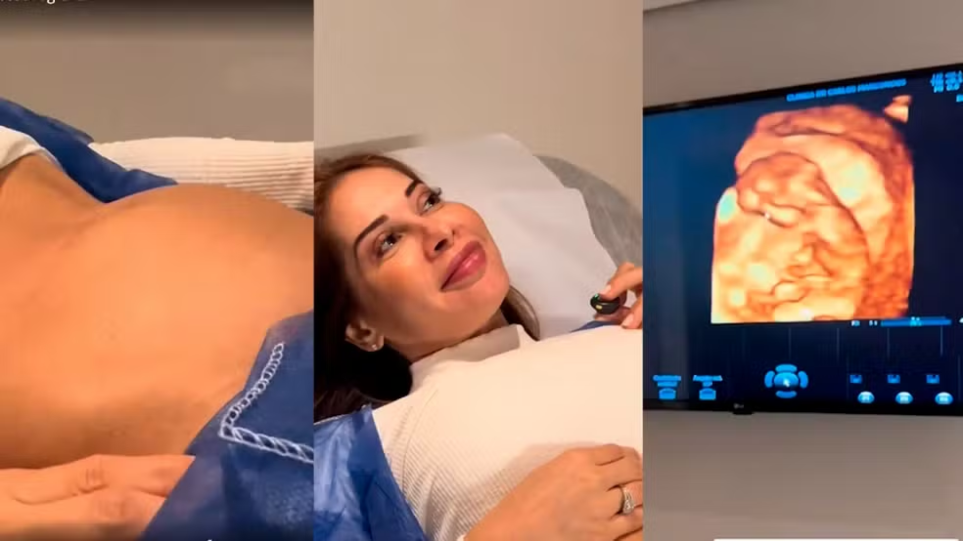 Maíra Cardi mostra primeira ultrassonografia do filho que espera de Thiago Nigro