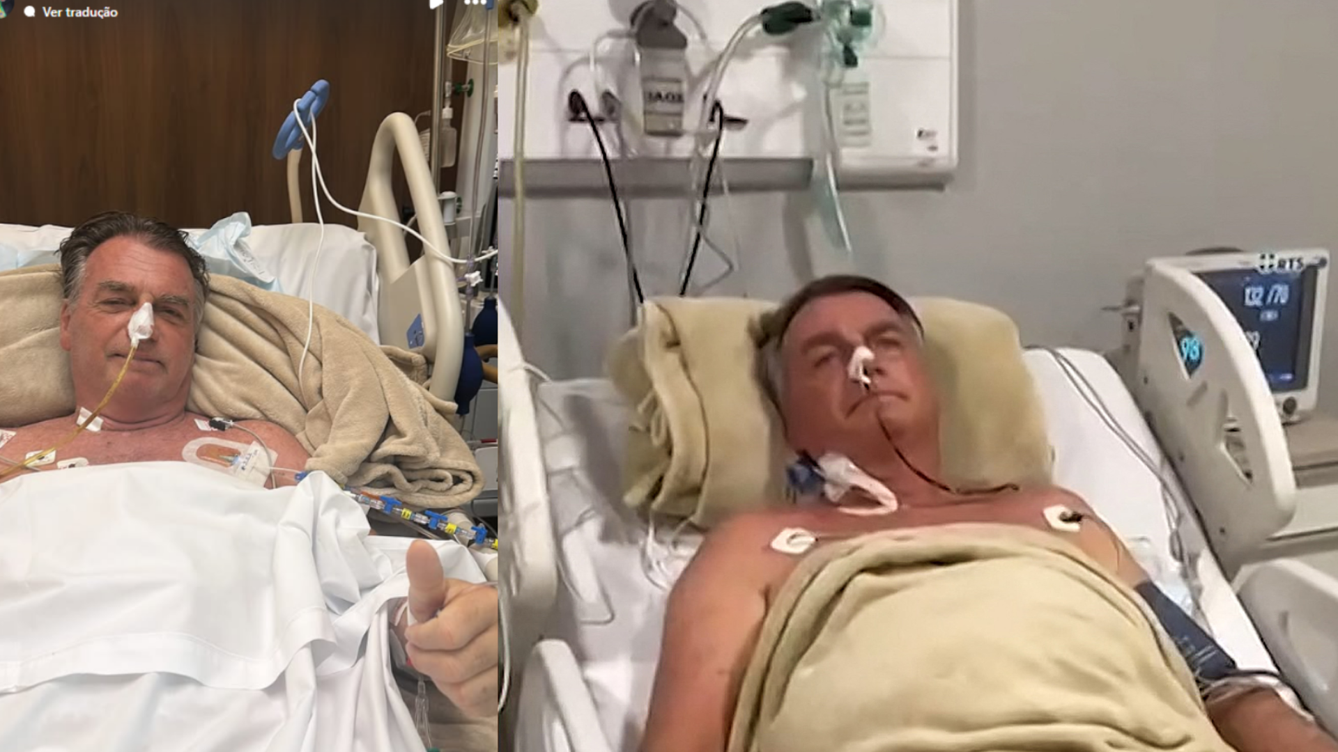 Na UTI após cirurgia, situação de Jair Bolsonaro é ‘delicada’; diz jornalista