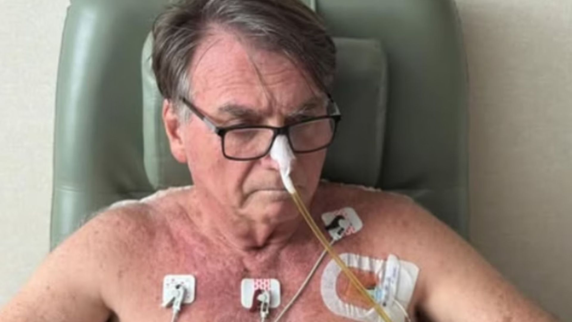 Como está Bolsonaro? Boletim médico atualiza quadro de saúde do ex-presidente