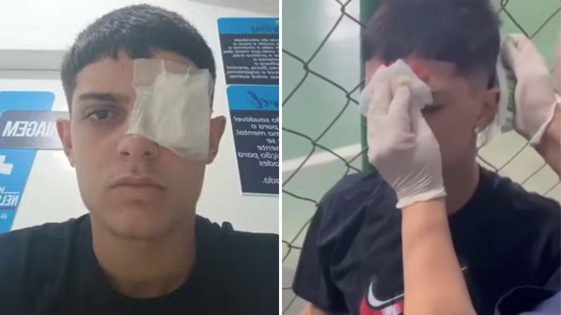 O que aconteceu com Daniel Pacheco? Médico explica perfuração no olho do jogador