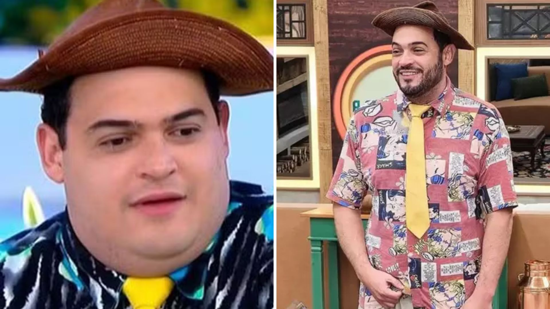 Pênis de Matheus Ceará aumentou após a bariátrica? Especialista explica caso