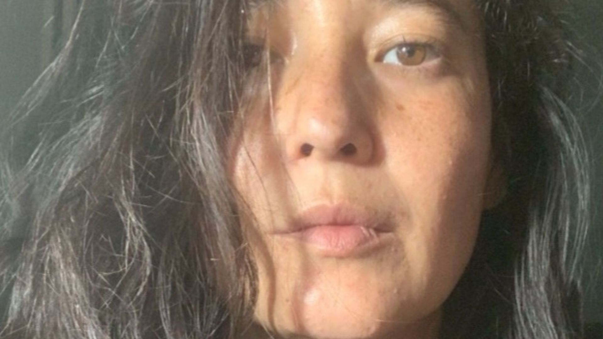 Lembra dela? Ex-‘Malhação’ Renata Sayuri desabafa após receber duro diagnóstico