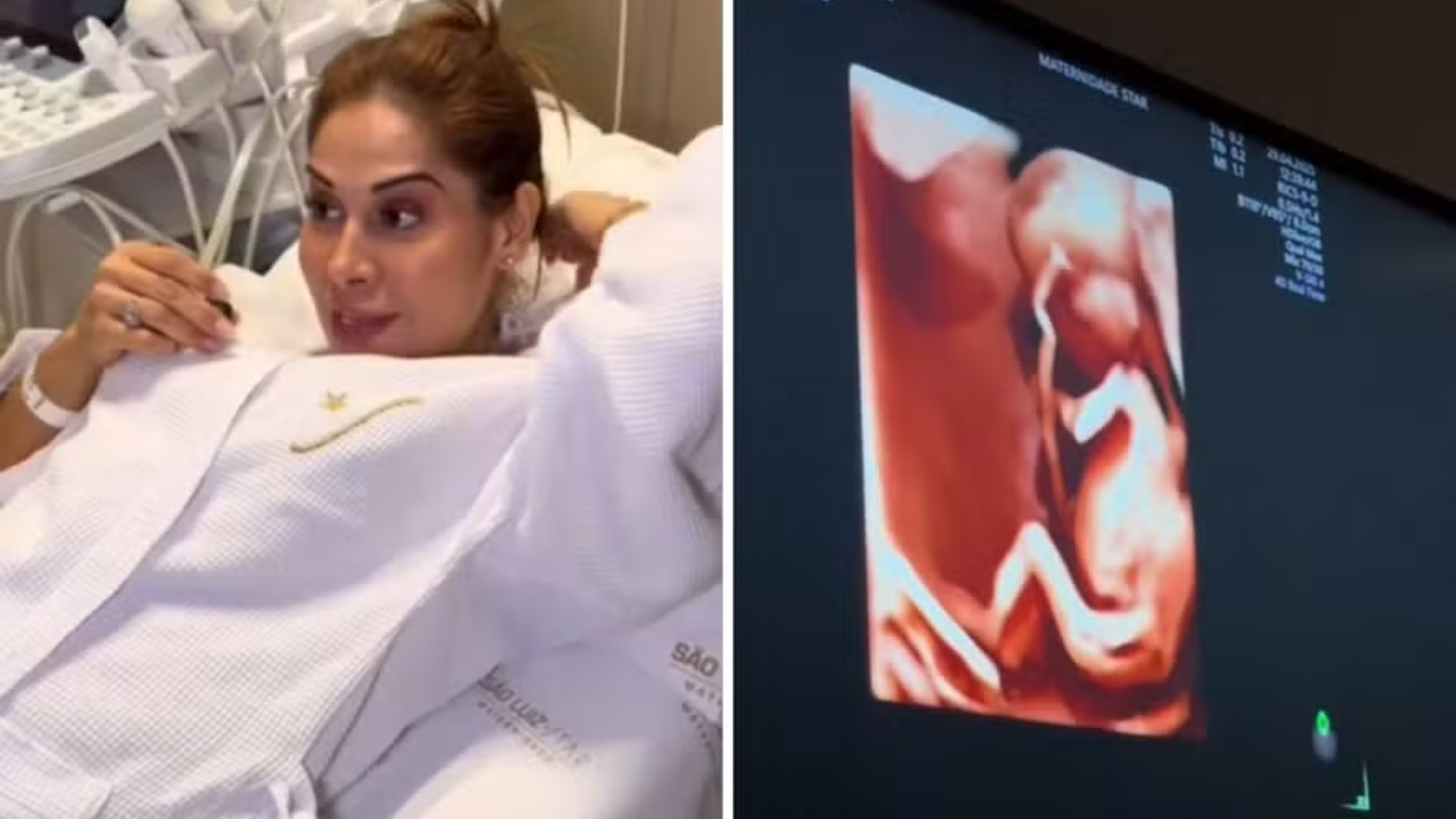 Com medo, Maíra Cardi faz ultrassom morfológico: ‘Meu coração tá angustiado’