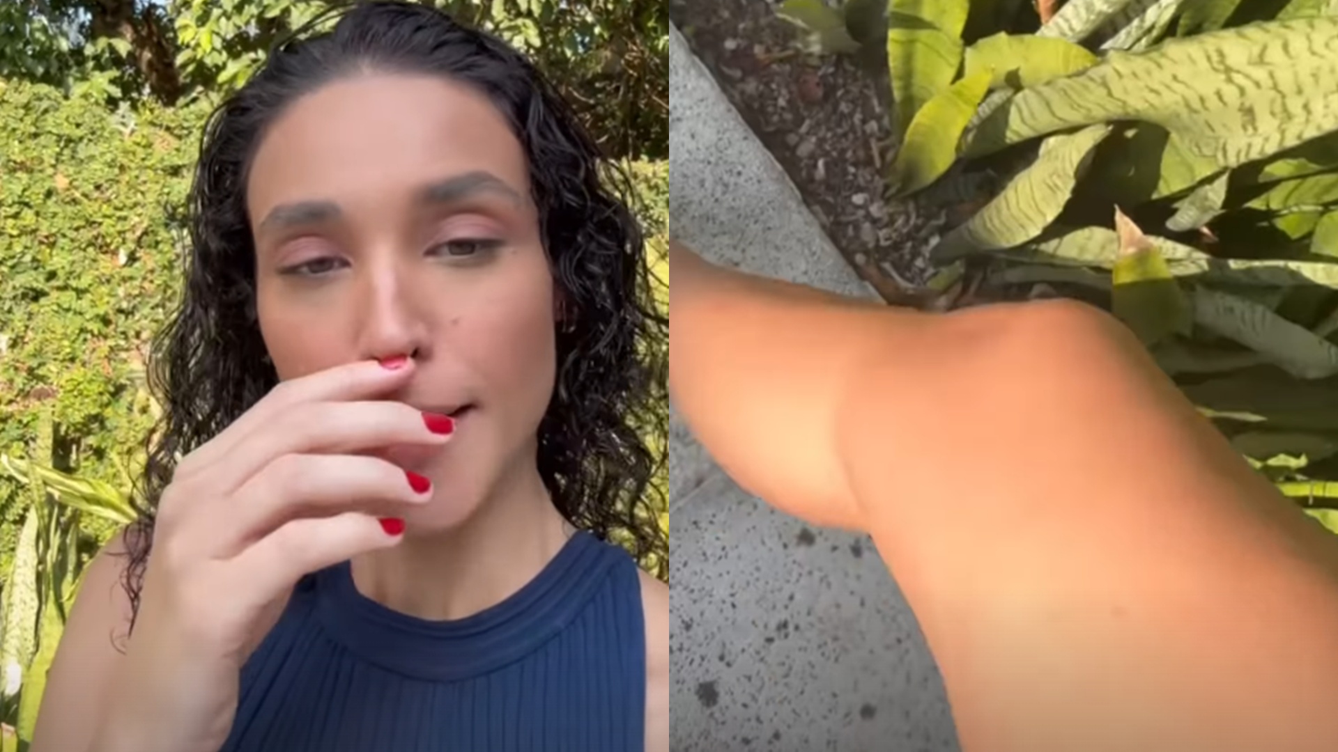 Débora Nascimento é atacada por mosquitos ao tomar sol pelada: ‘Onde não tem marquinha’