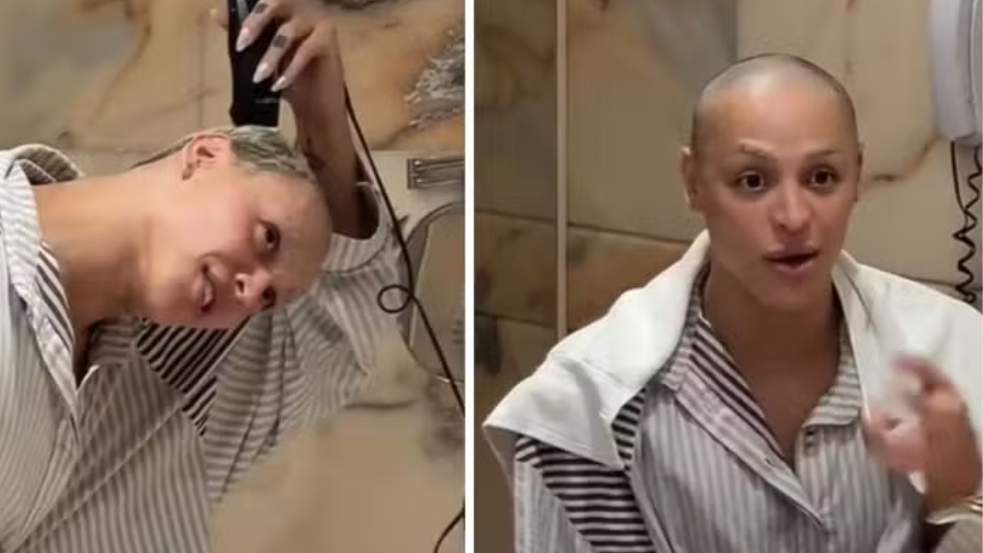 Doente? Pabllo Vittar choca fãs ao surgir careca e revela o que houve
