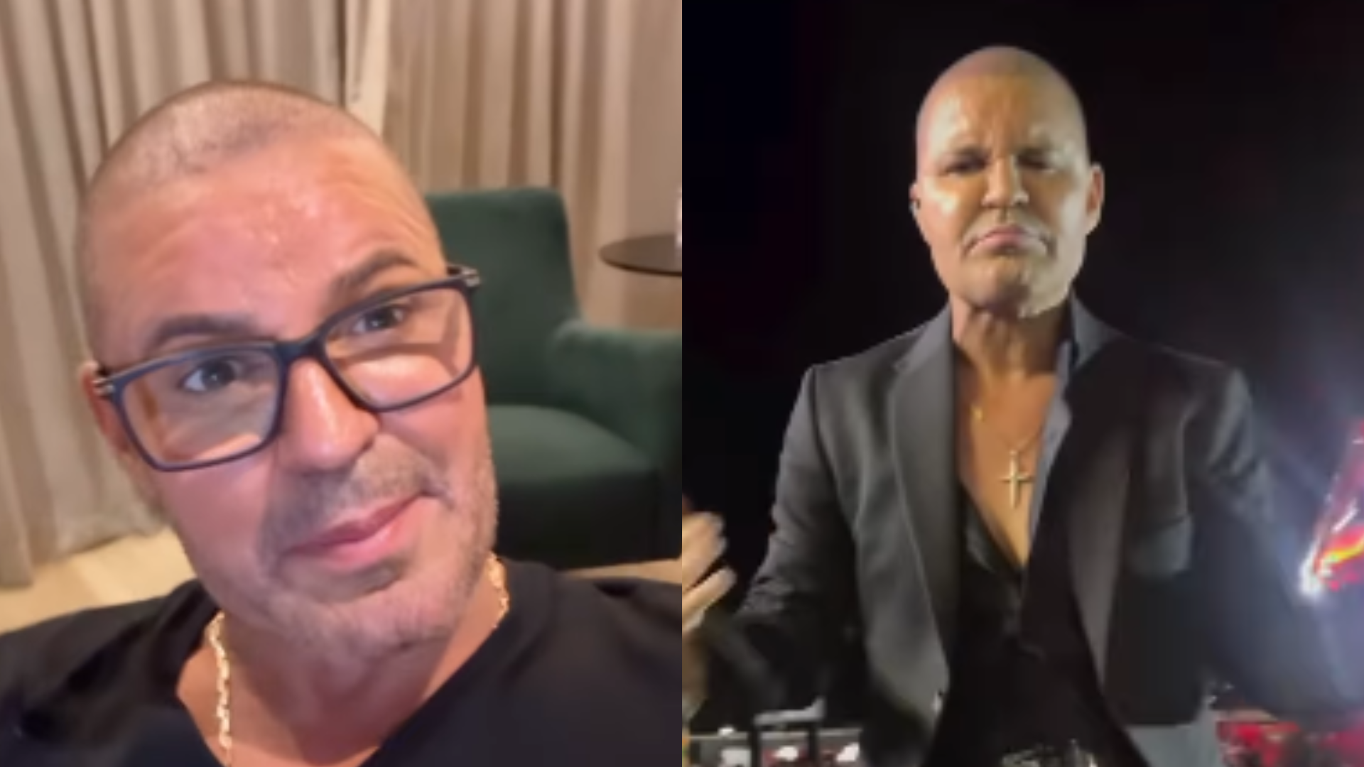 Eduardo Costa revela motivo inusitado da queda de seu cabelo: ‘Usei muita’