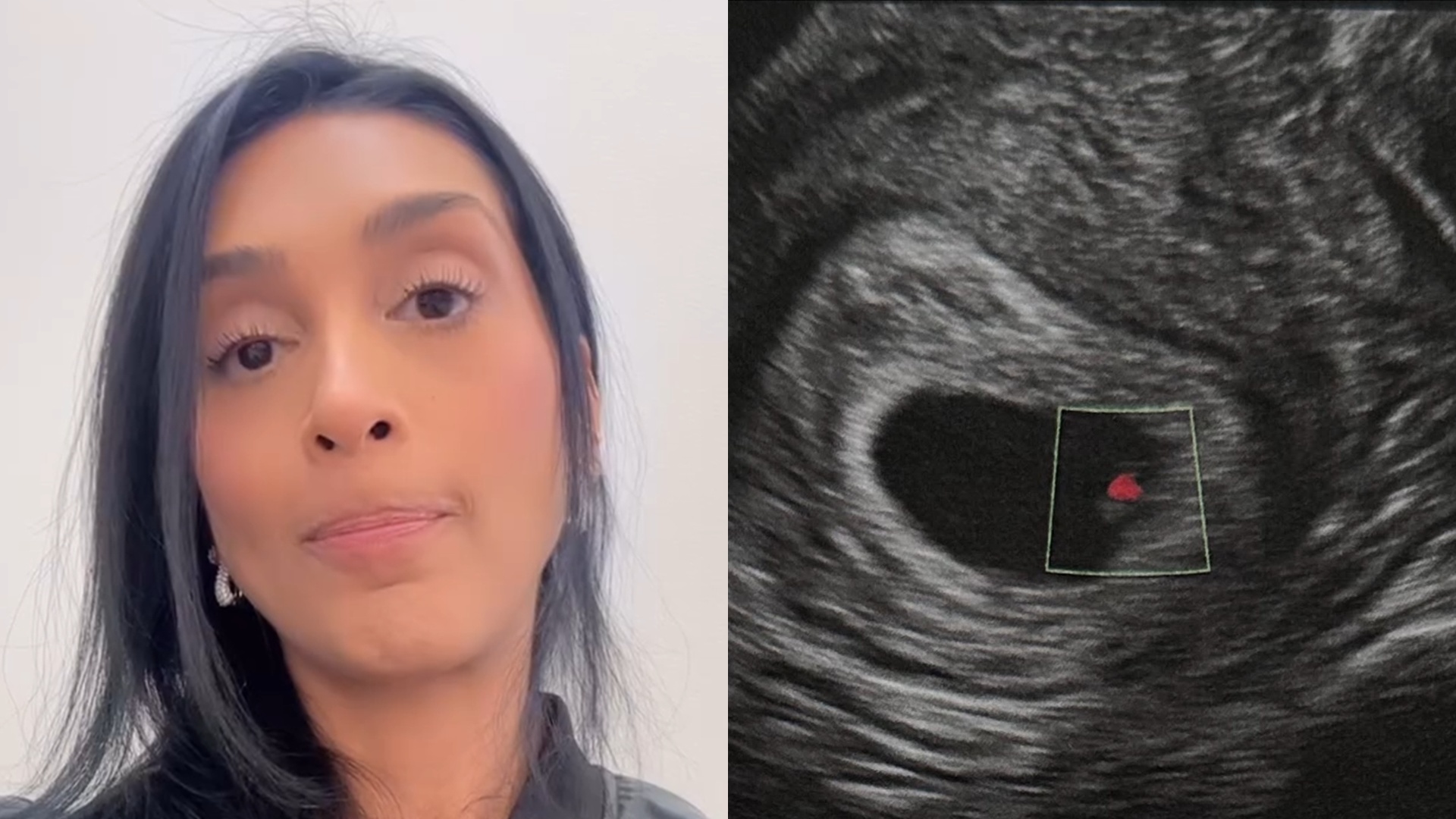 Ex-BBB Amanda Djehdian faz duro desabafo no Dia das Mães após perder o bebê: ‘Anjo’